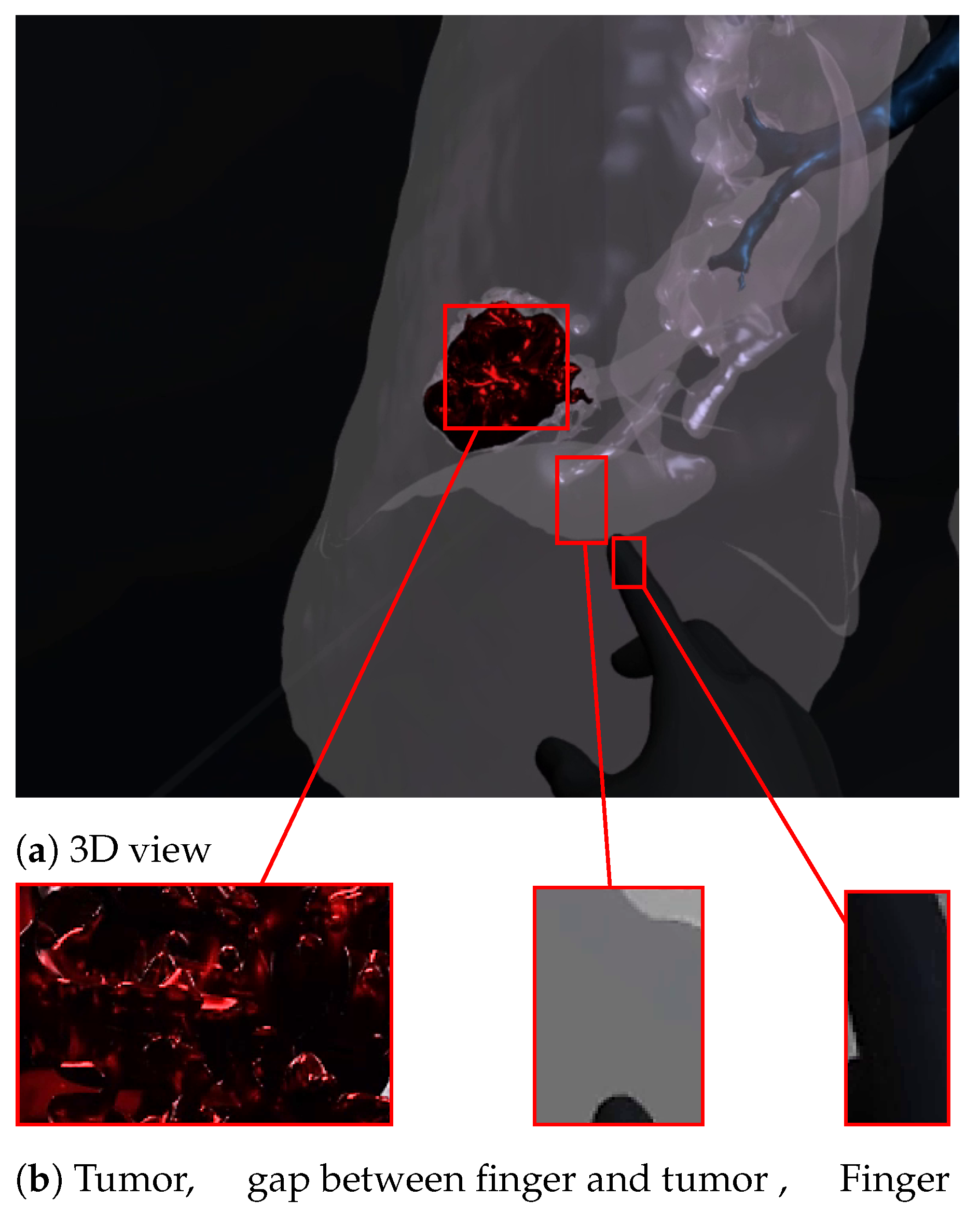 Diagnostics 13 00567 g007