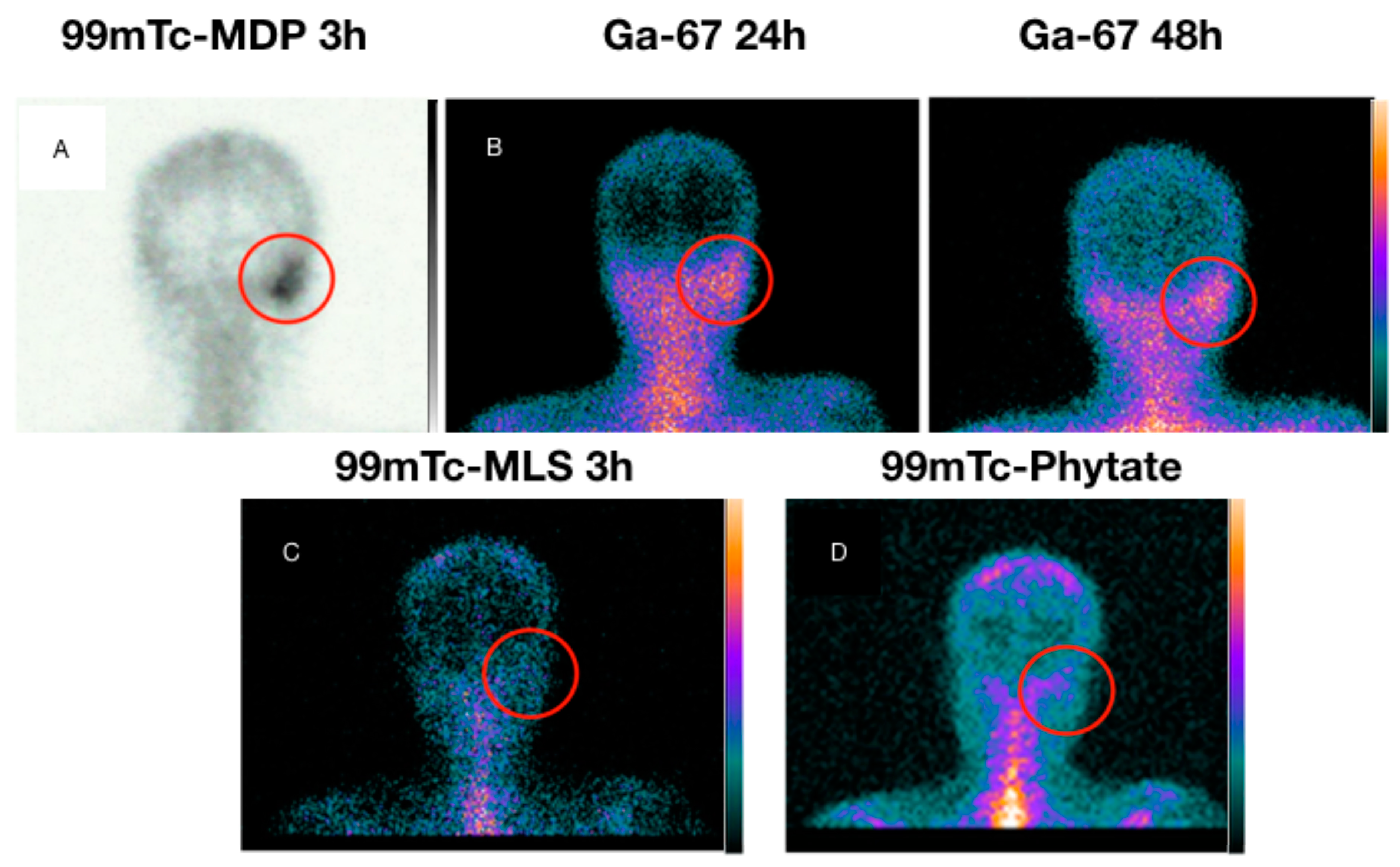 Diagnostics 13 00570 g004