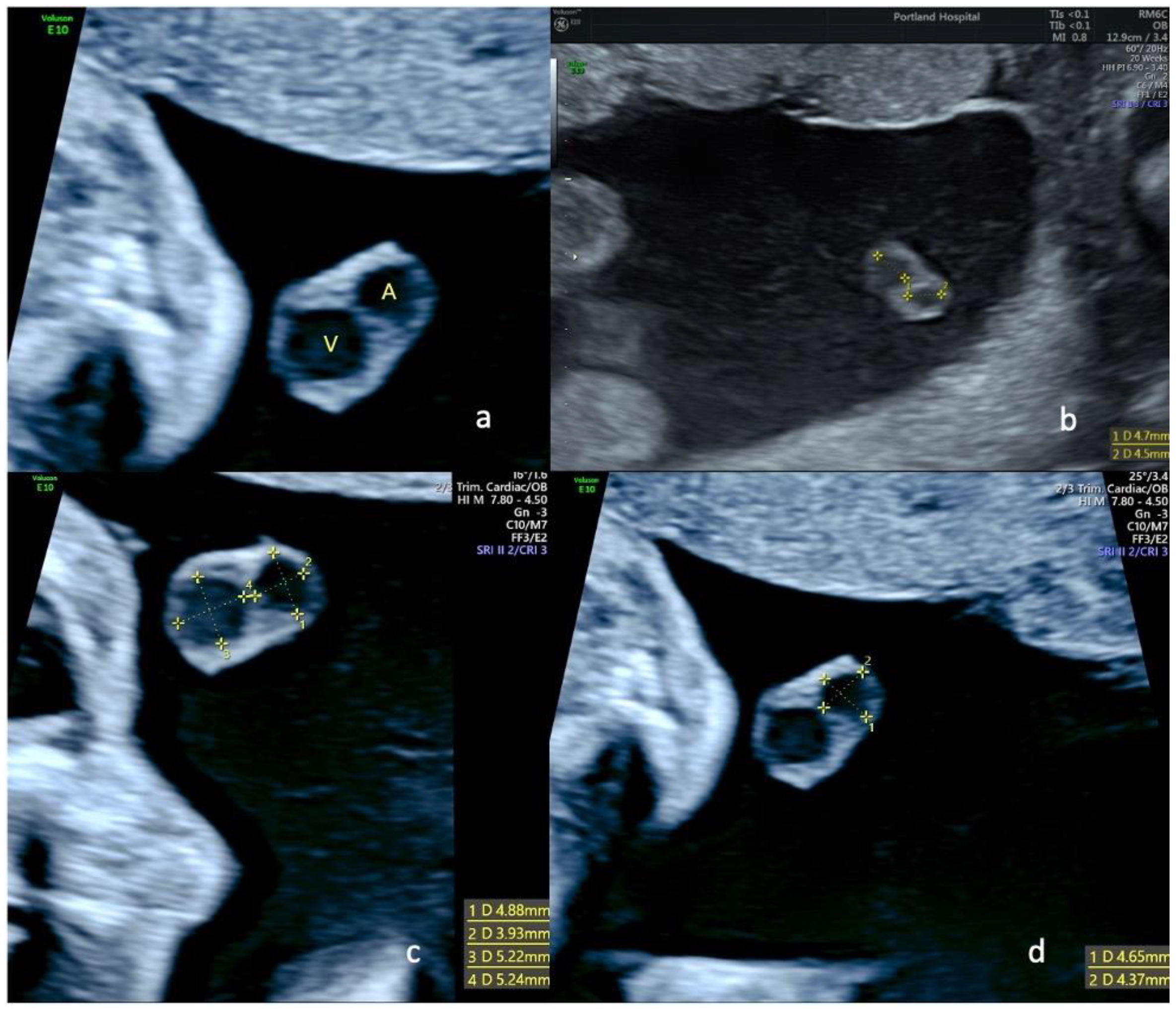 Diagnostics 13 00571 g002