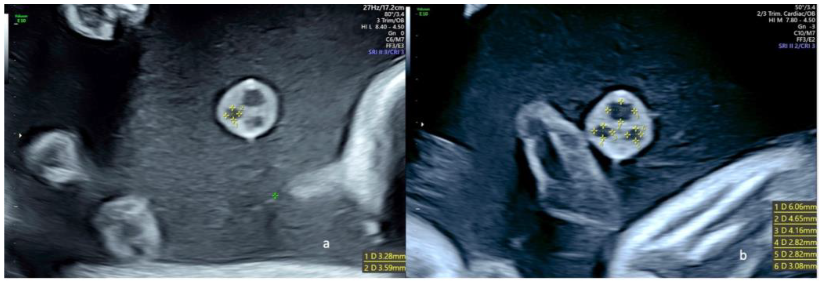 Diagnostics 13 00571 g003