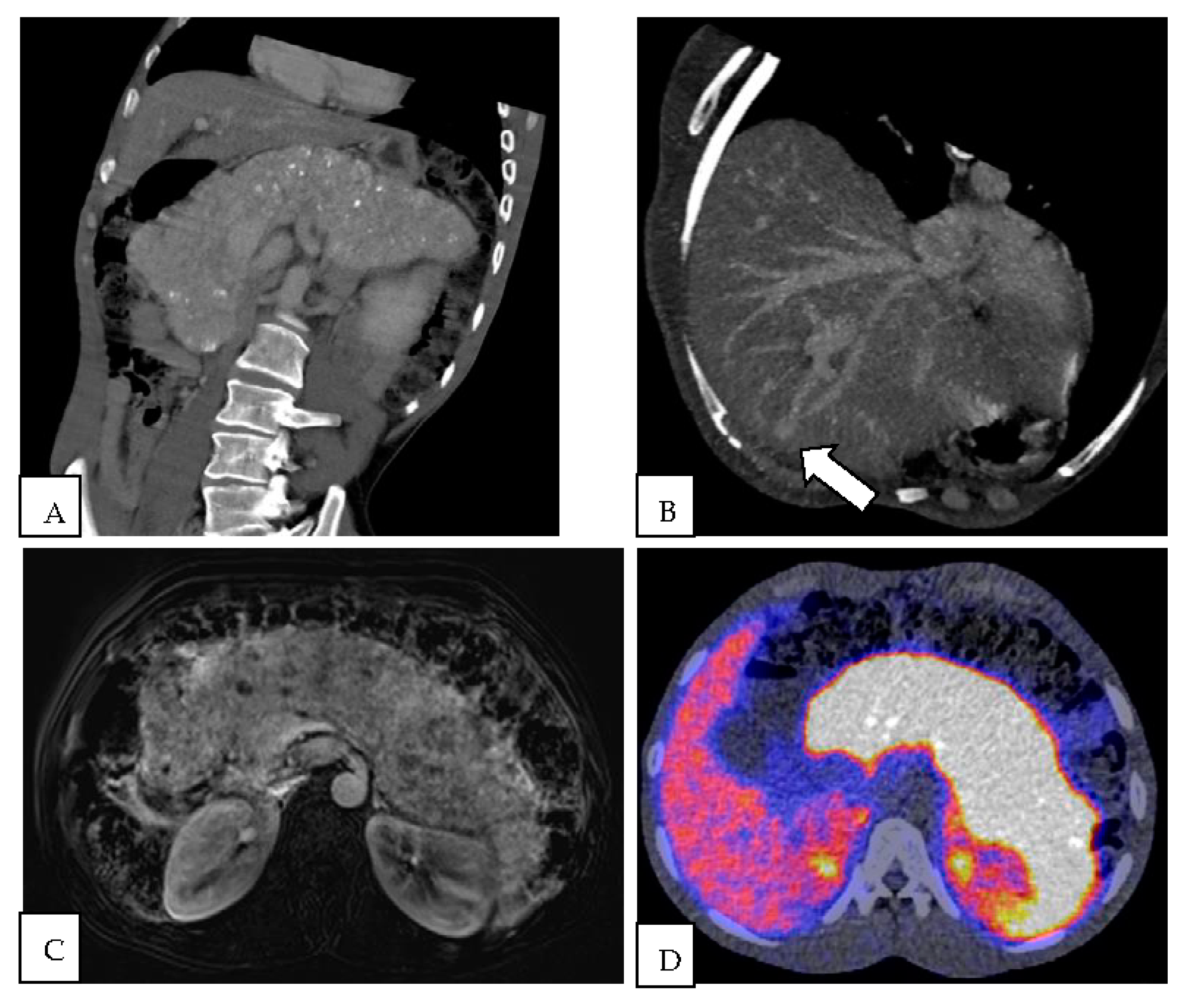 Diagnostics 13 00572 g001