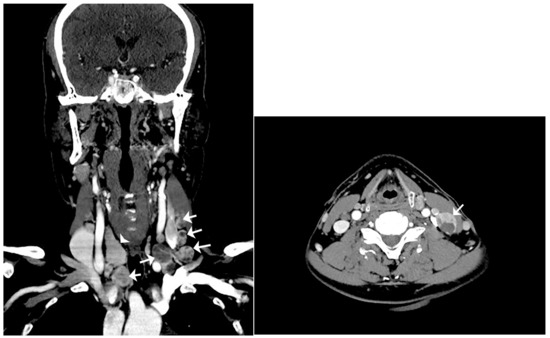 Diagnostics 13 00577 g002 550