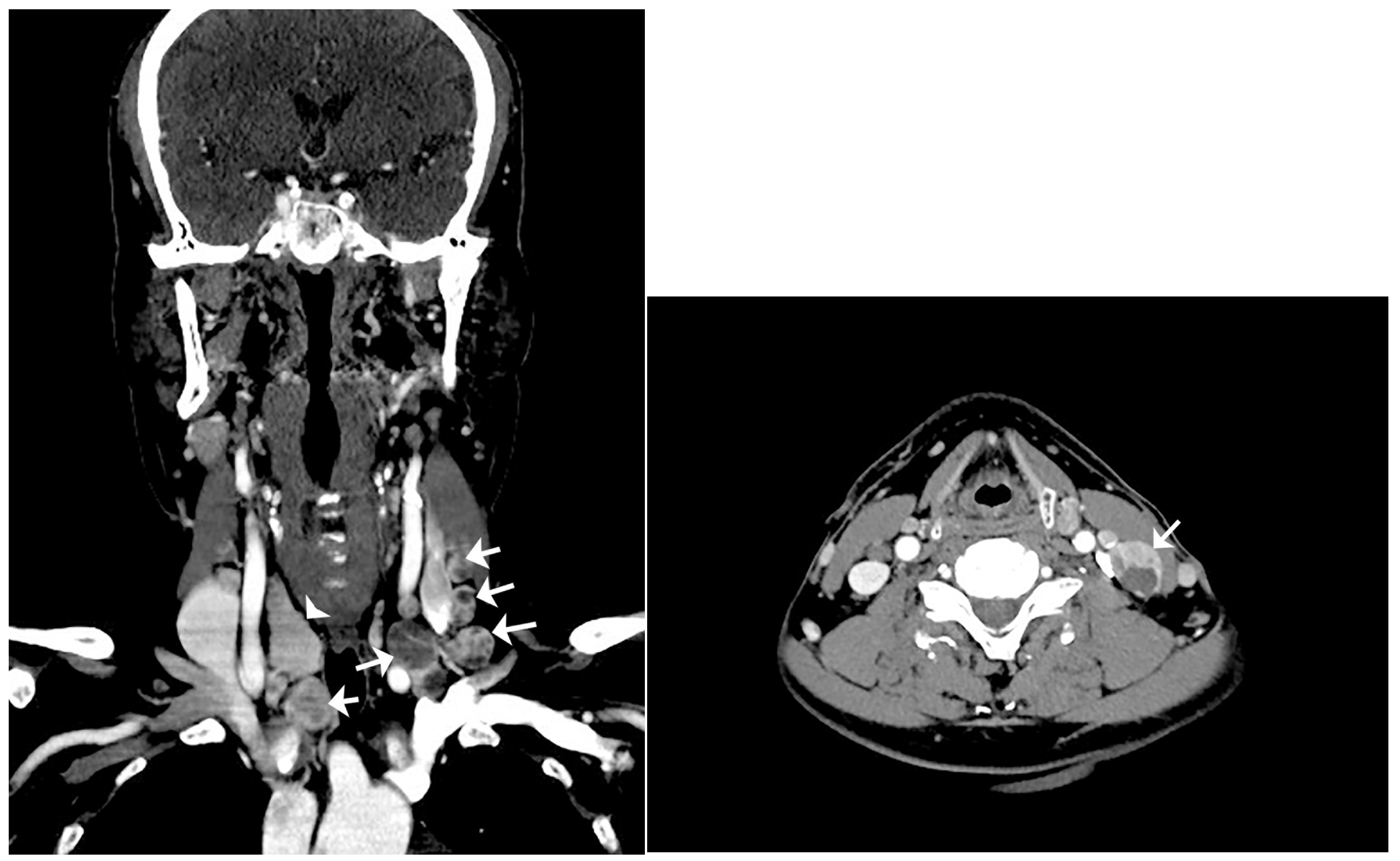 Diagnostics 13 00577 g002
