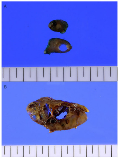 Diagnostics 13 00577 g003 550