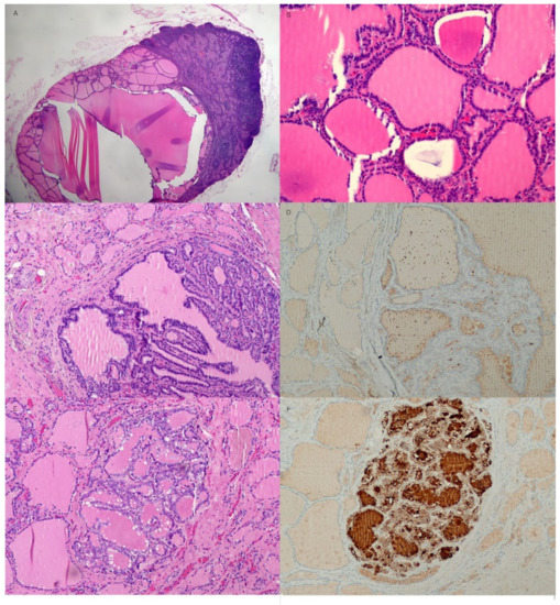 Diagnostics 13 00577 g004 550