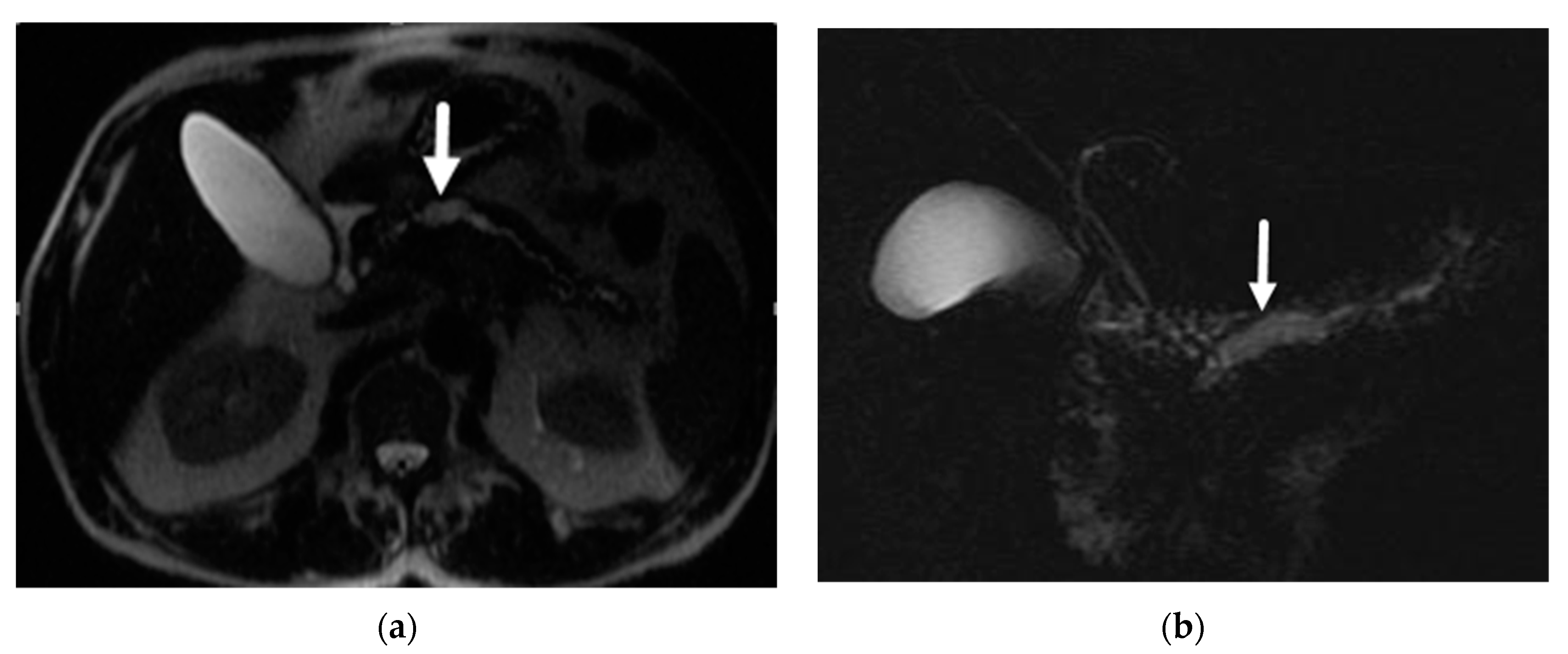 Diagnostics 13 00585 g002