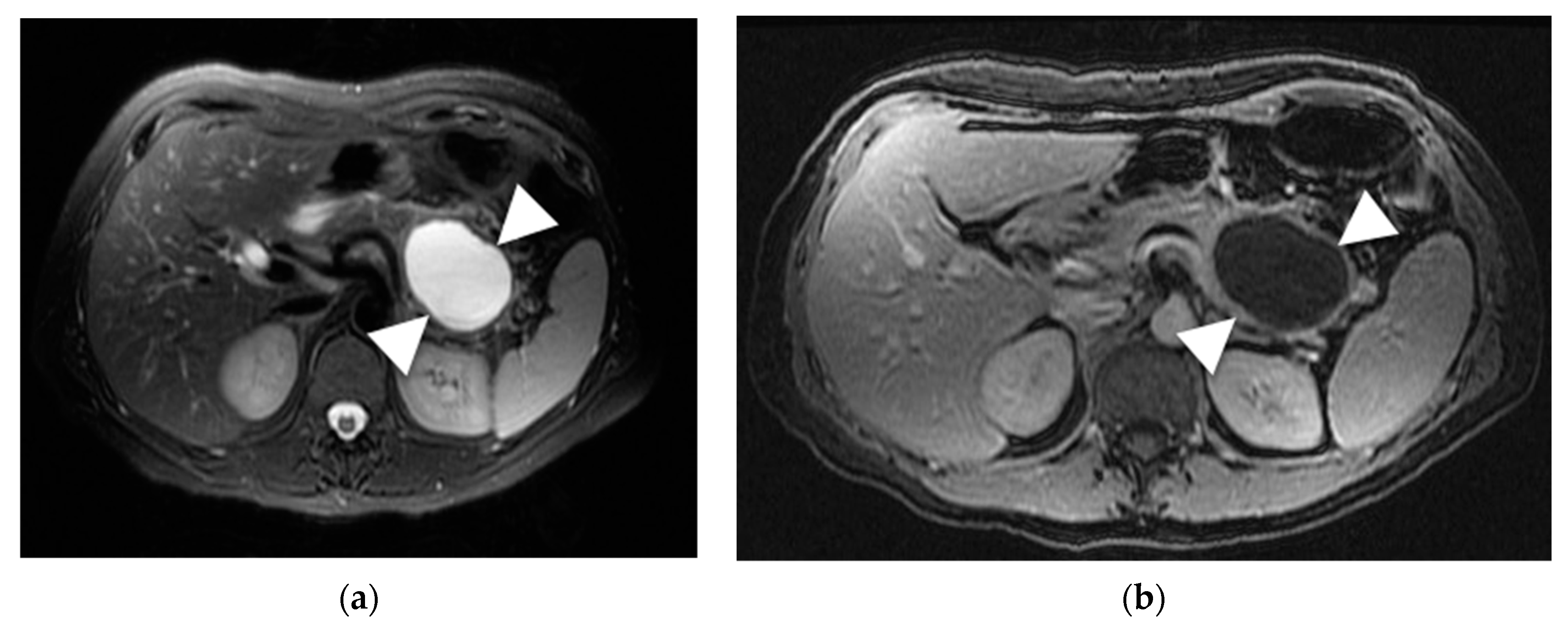 Diagnostics 13 00585 g003