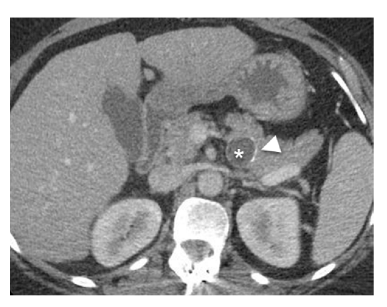Diagnostics 13 00585 g004