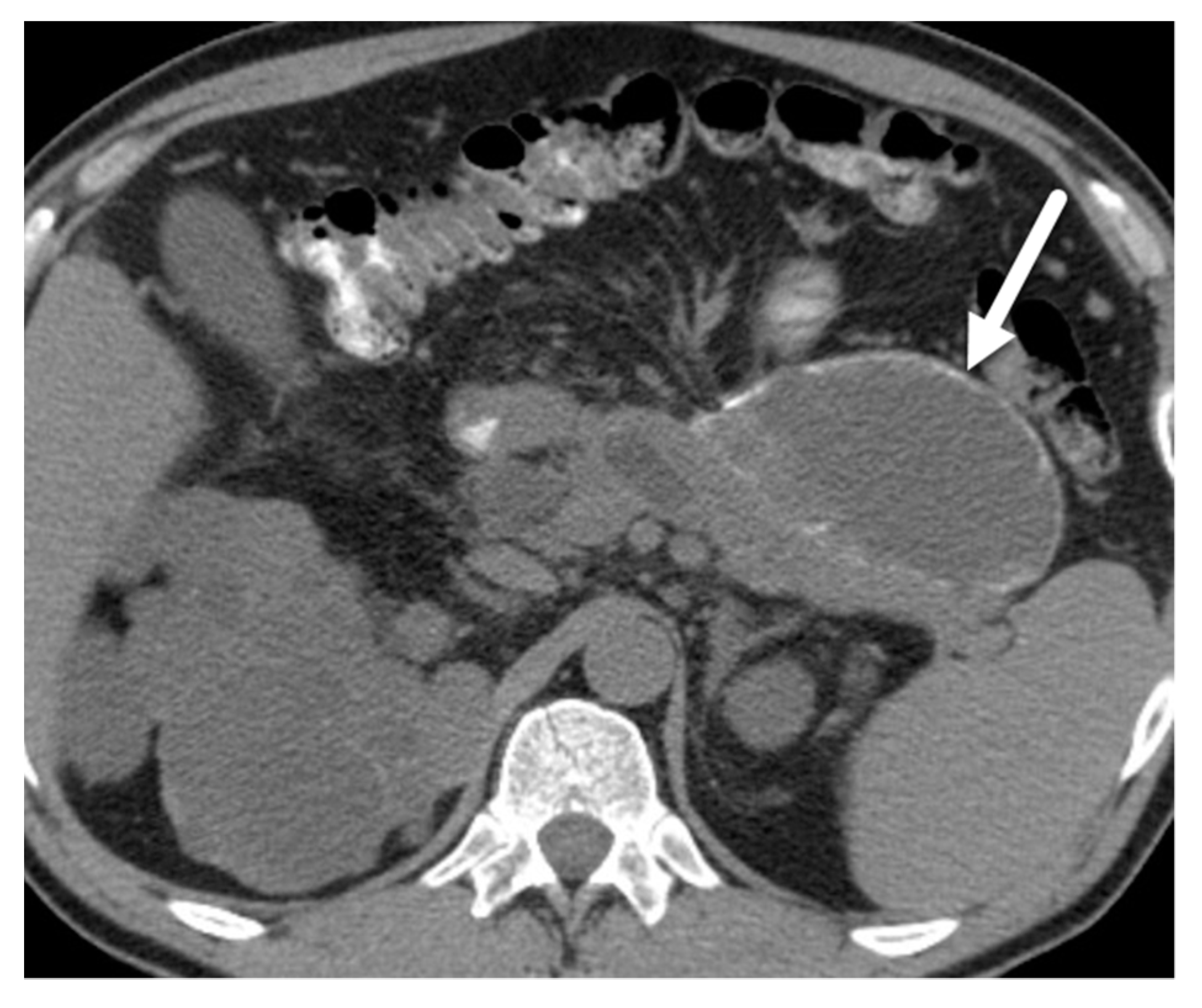 Diagnostics 13 00585 g007