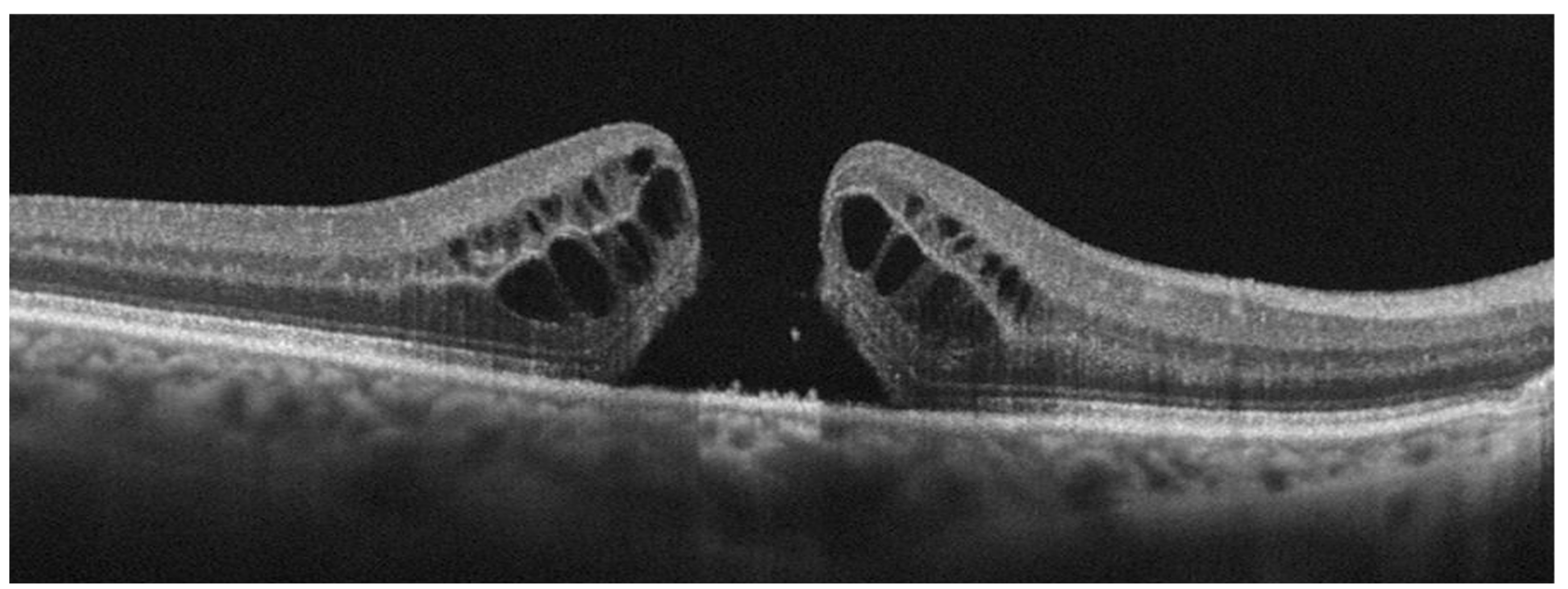 Diagnostics 13 00589 g003