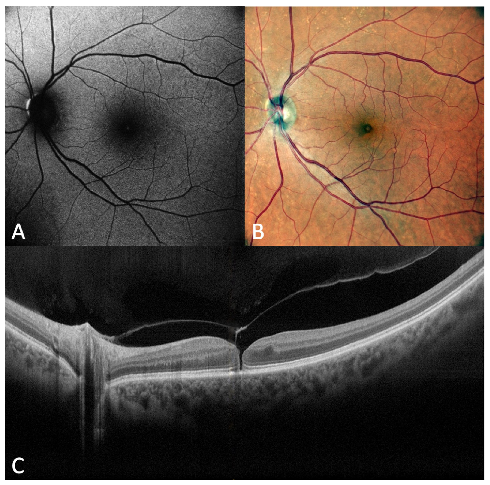 Diagnostics 13 00589 g009