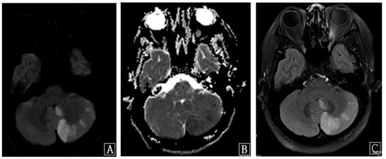 Diagnostics 13 00595 g002