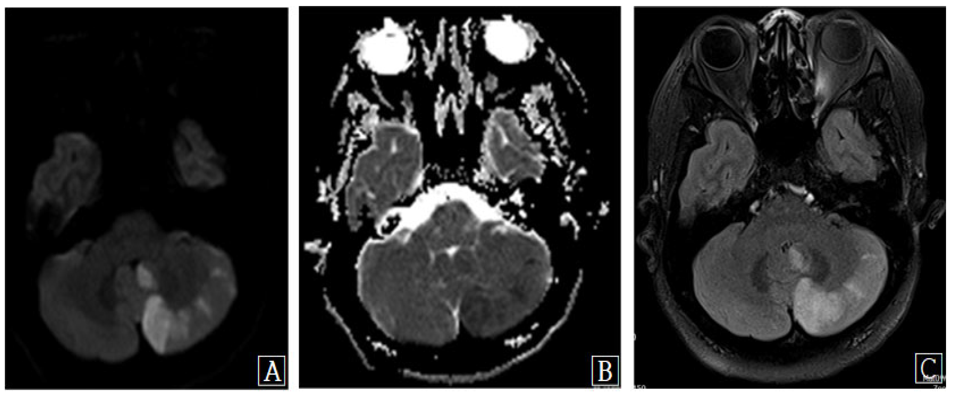 Diagnostics 13 00595 g002