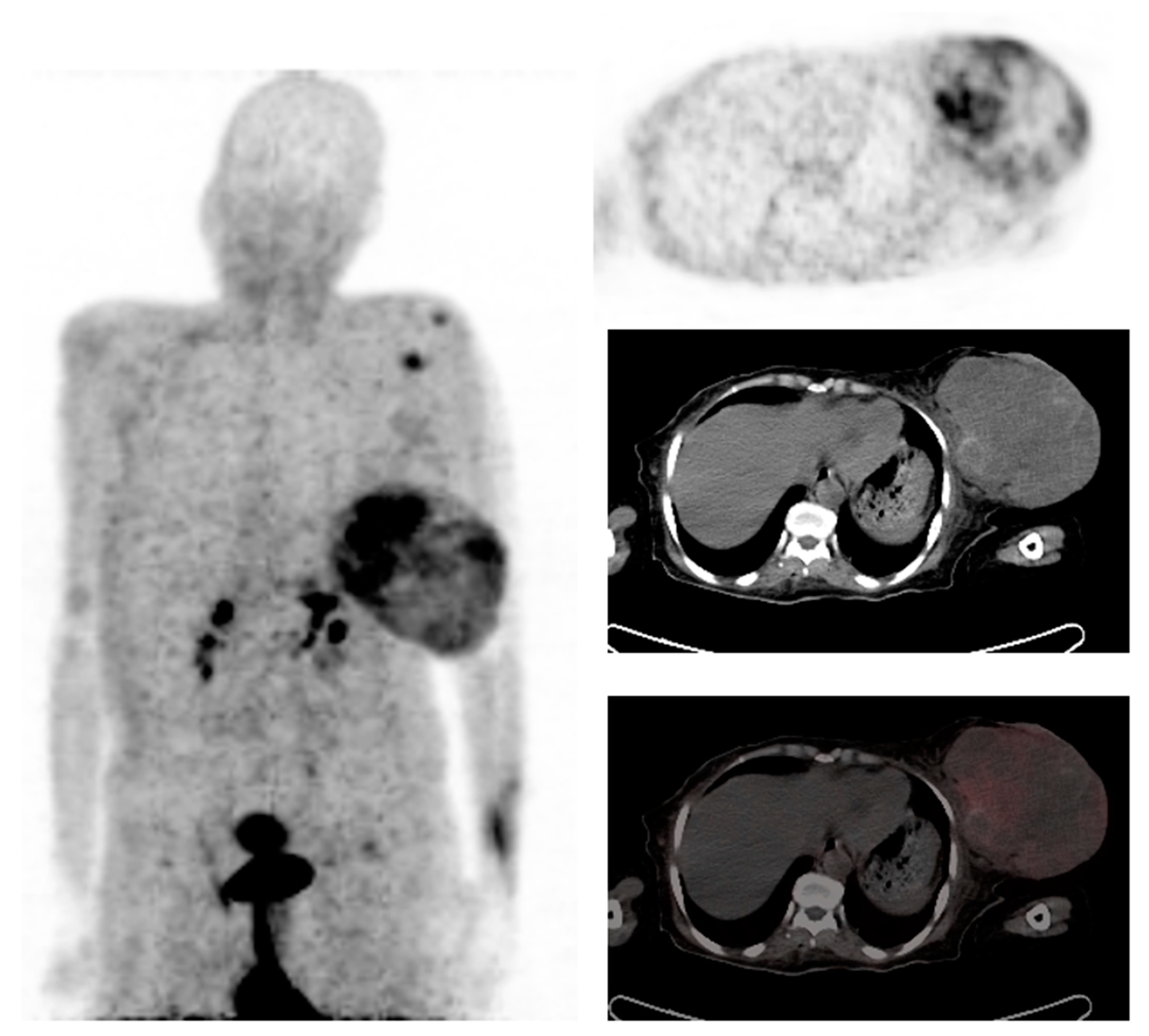 Diagnostics 13 00597 g002 Diagnostics 13 00597 g002