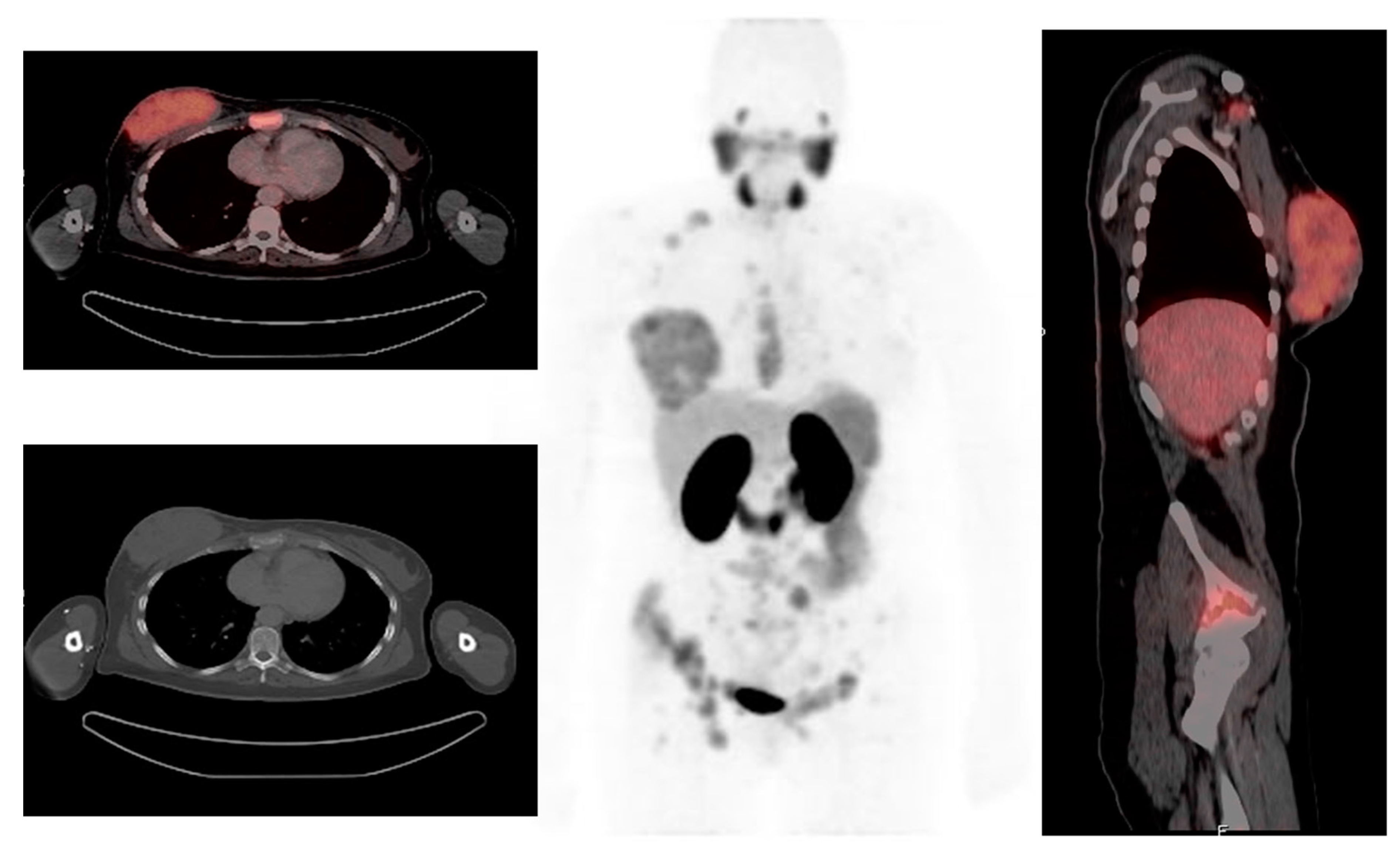 Diagnostics 13 00597 g003 Diagnostics 13 00597 g003