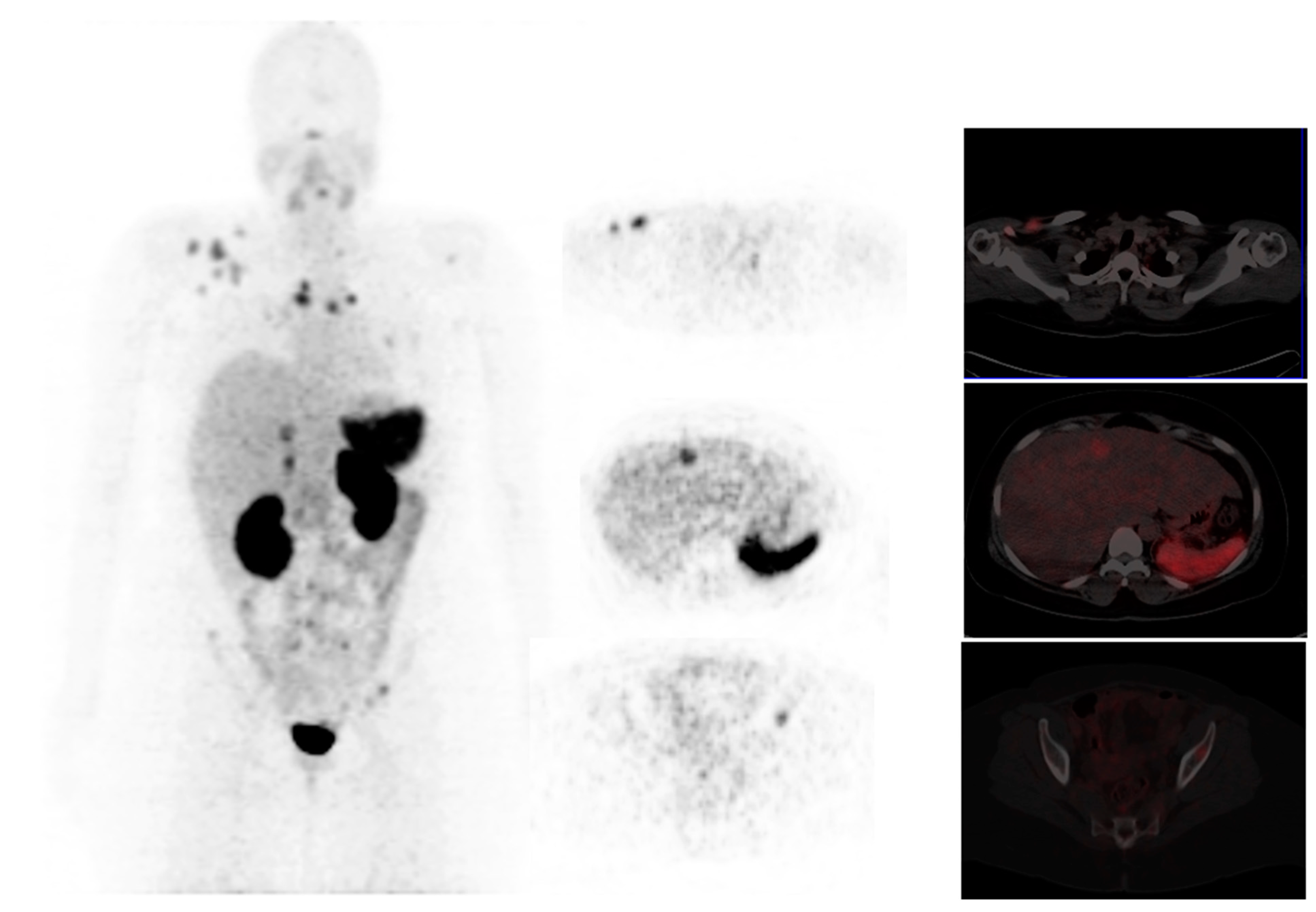 Diagnostics 13 00597 g005 Diagnostics 13 00597 g005