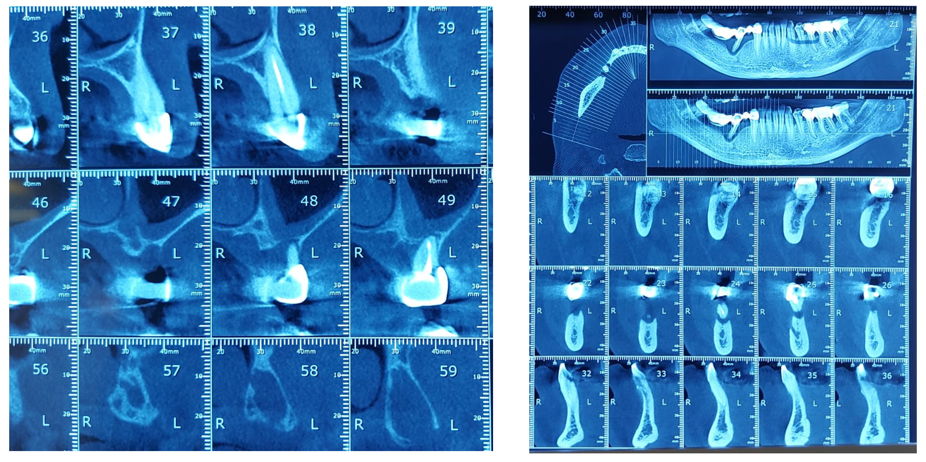 Diagnostics 13 00598 g007
