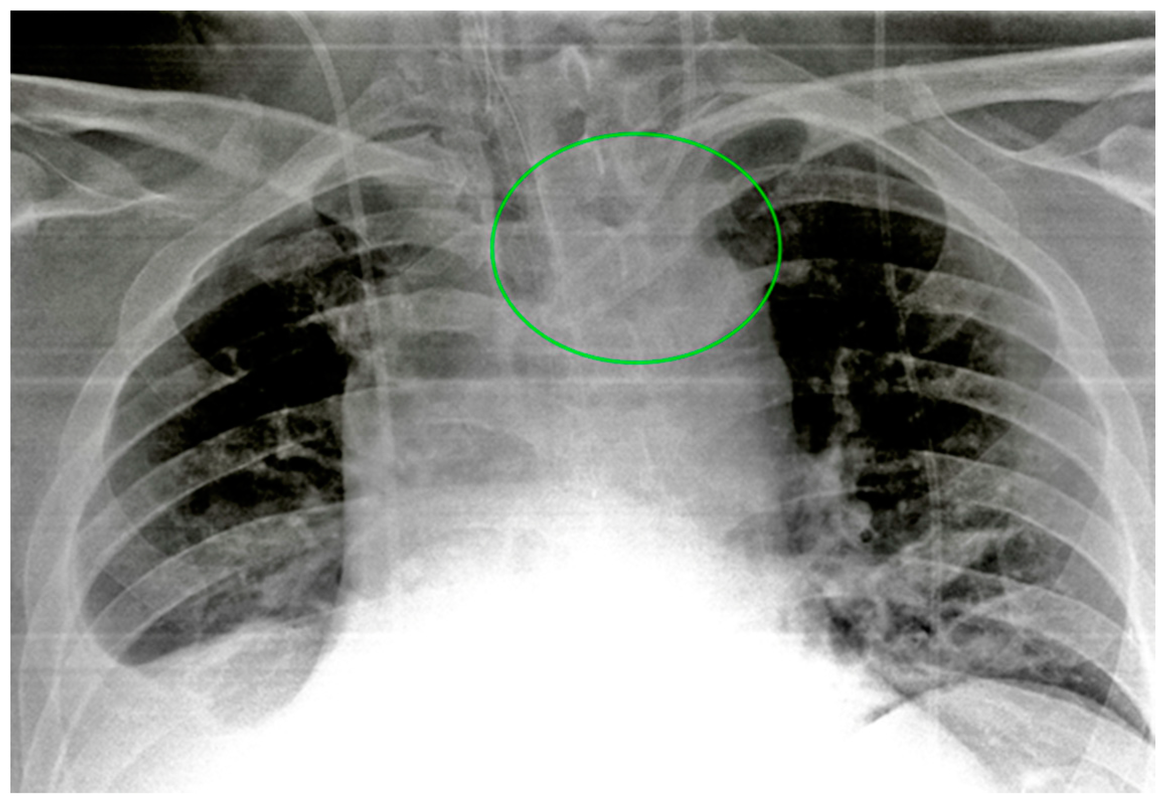 Diagnostics 13 00599 g005 Diagnostics 13 00599 g005