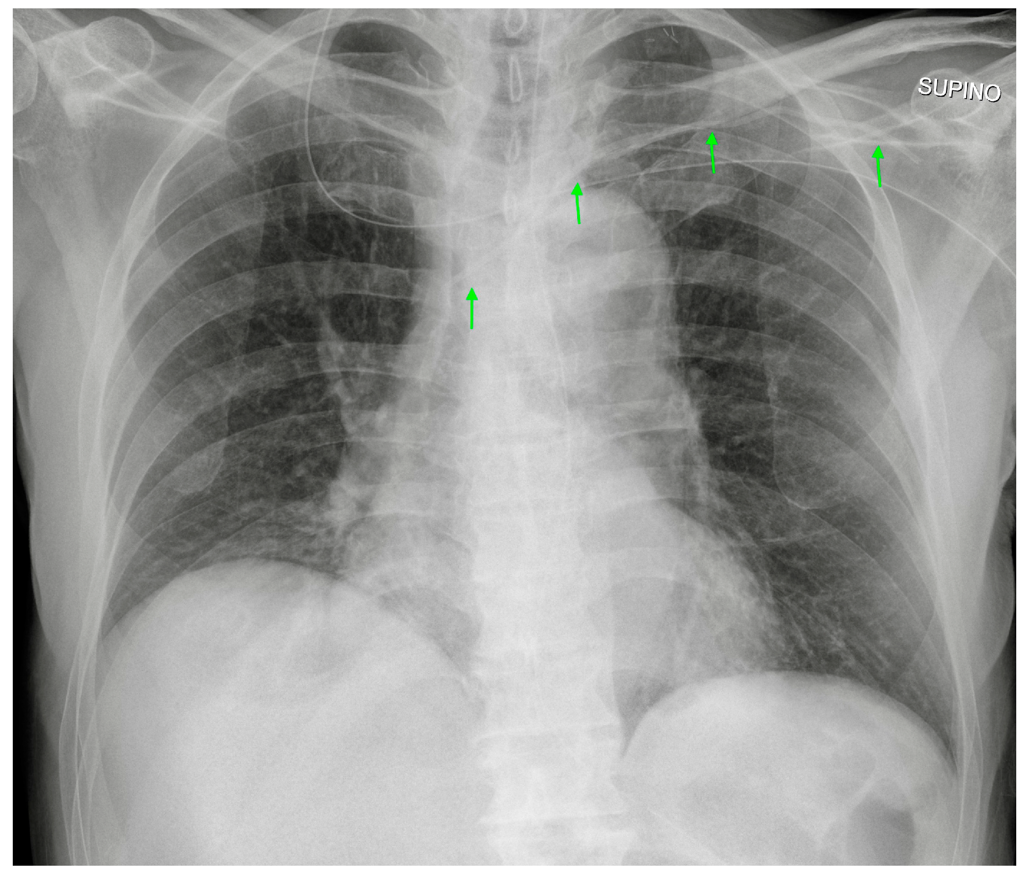 Diagnostics 13 00599 g006 Diagnostics 13 00599 g006