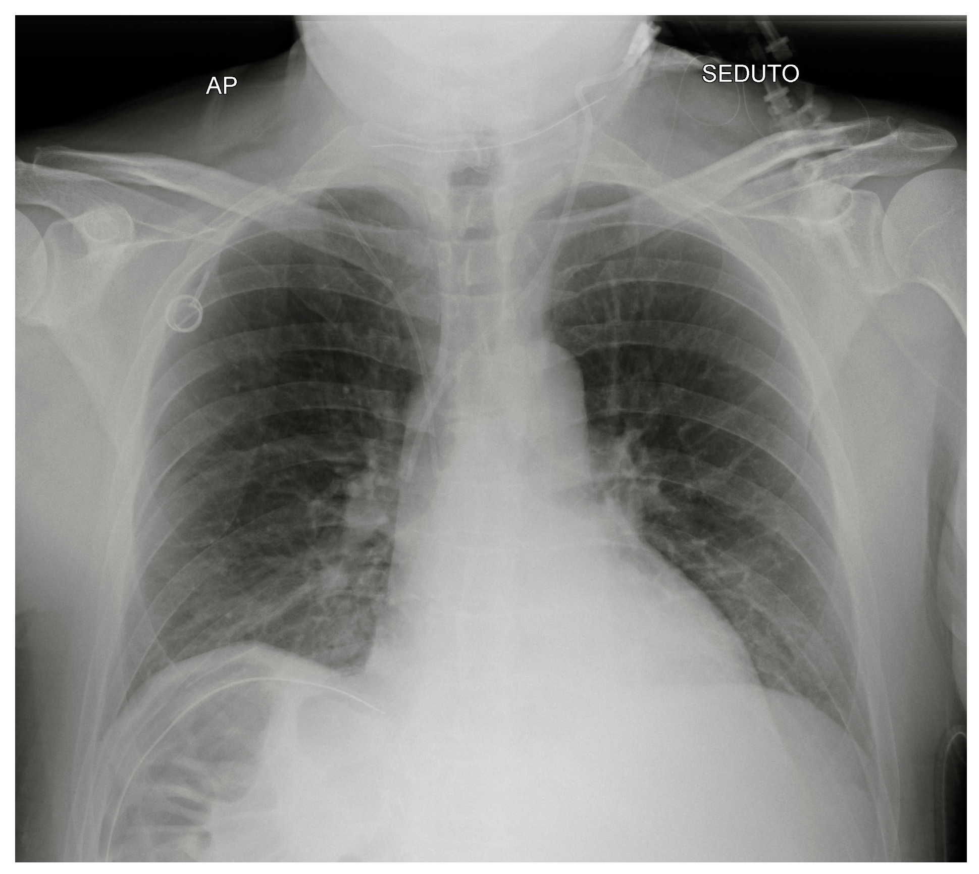 Diagnostics 13 00599 g007 Diagnostics 13 00599 g007