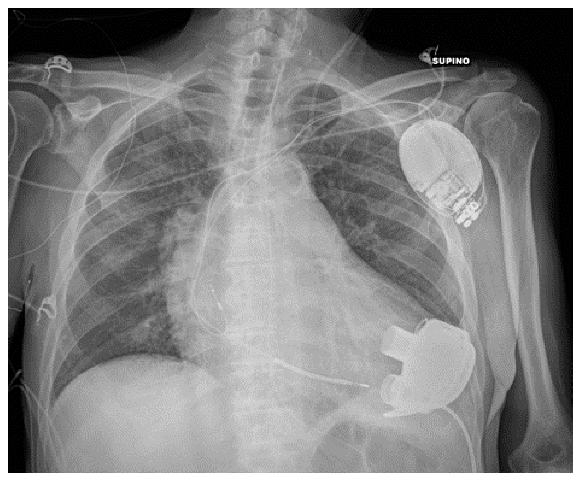 Diagnostics 13 00599 g015 Diagnostics 13 00599 g015