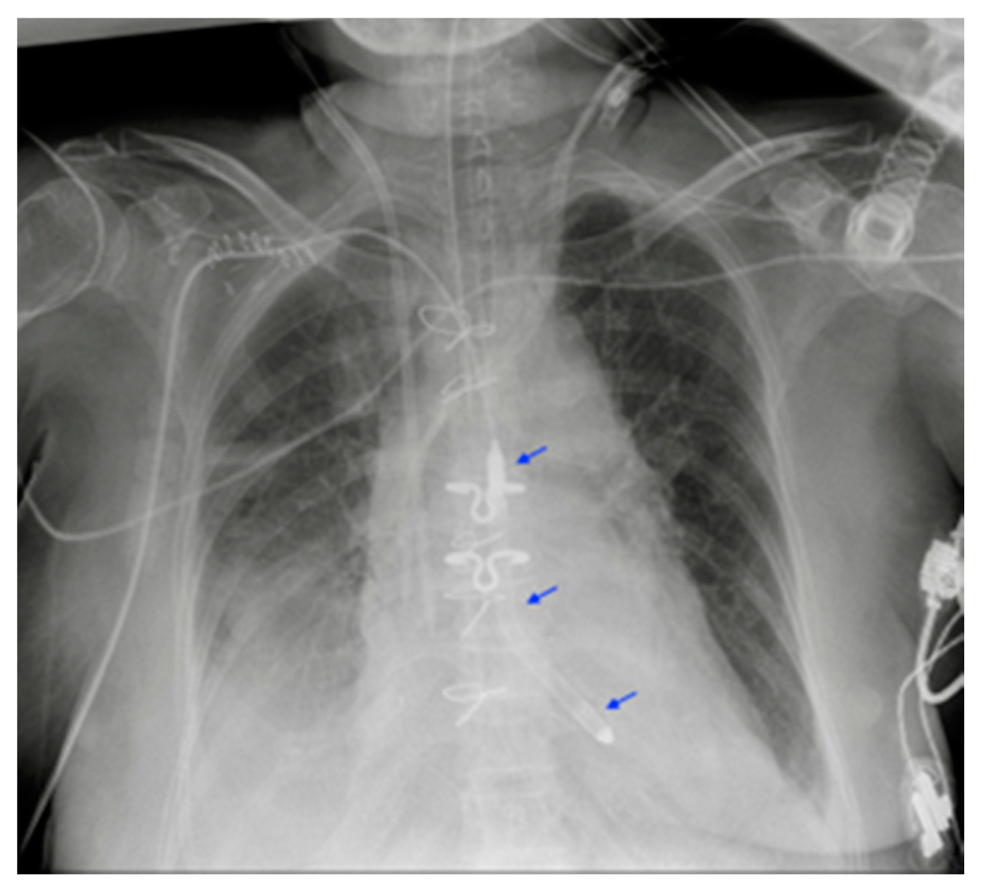 Diagnostics 13 00599 g016 Diagnostics 13 00599 g016