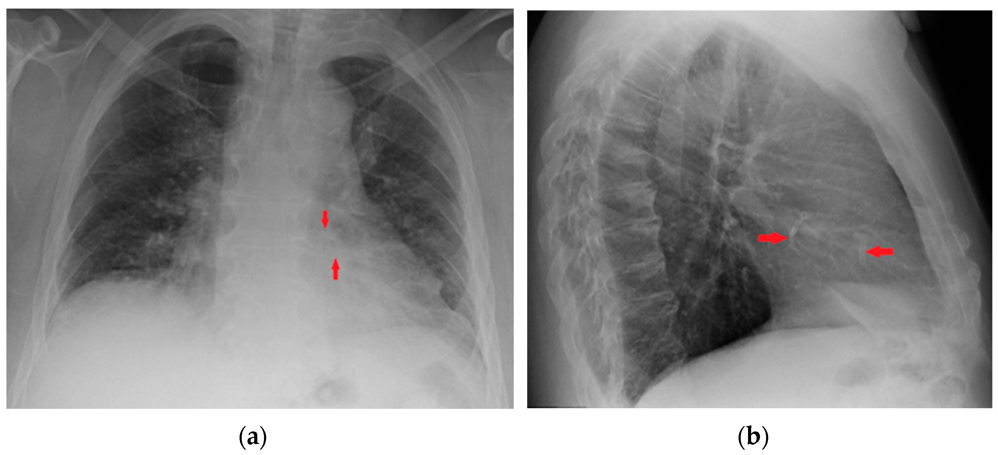 Diagnostics 13 00599 g019 Diagnostics 13 00599 g019