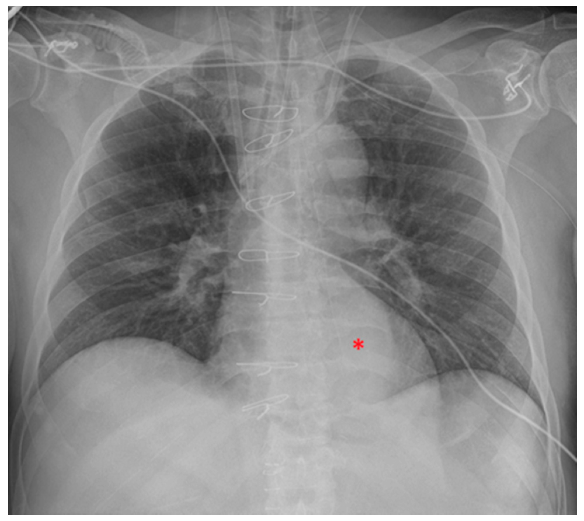 Diagnostics 13 00599 g022 Diagnostics 13 00599 g022