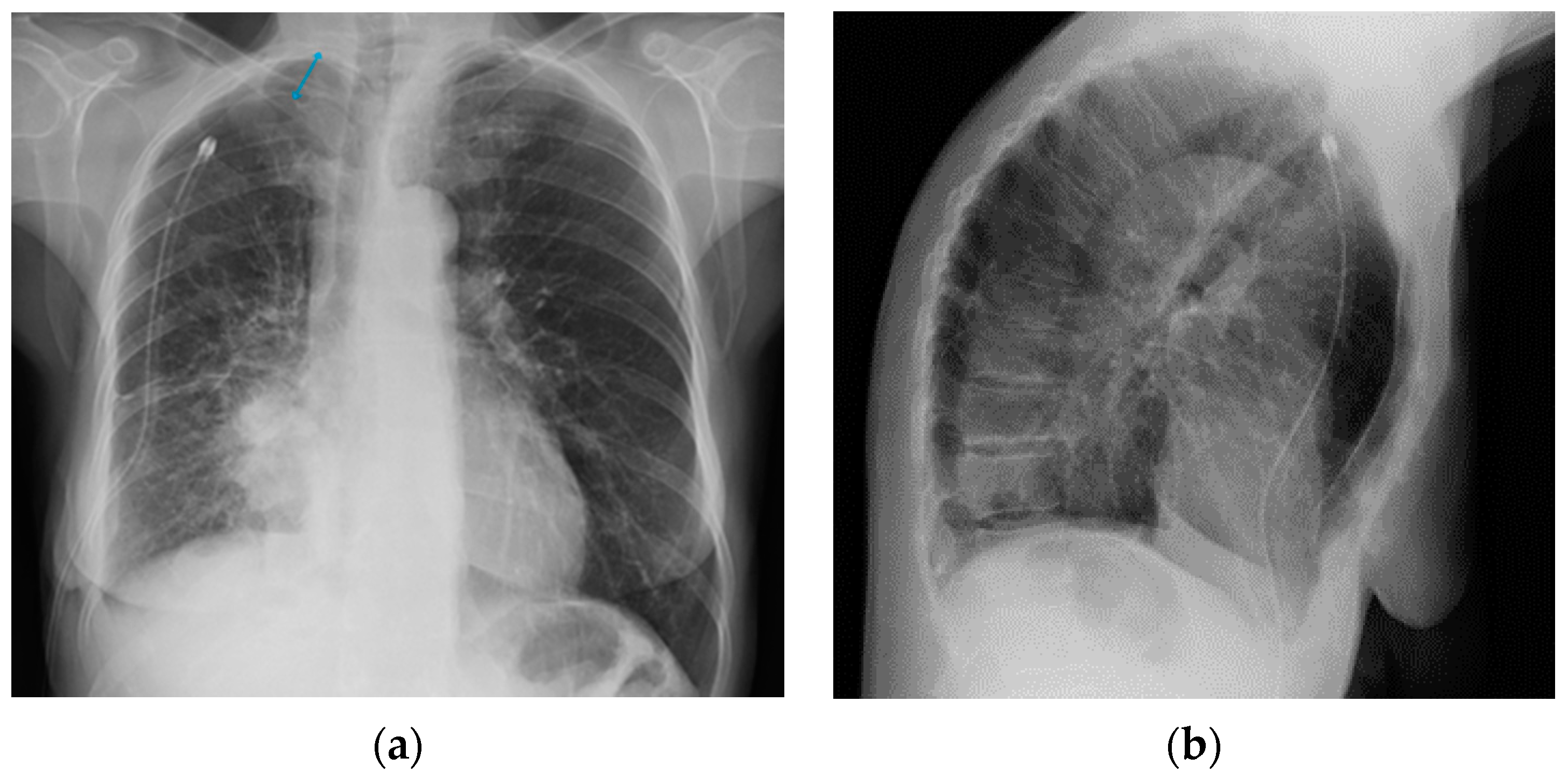 Diagnostics 13 00599 g028 Diagnostics 13 00599 g028