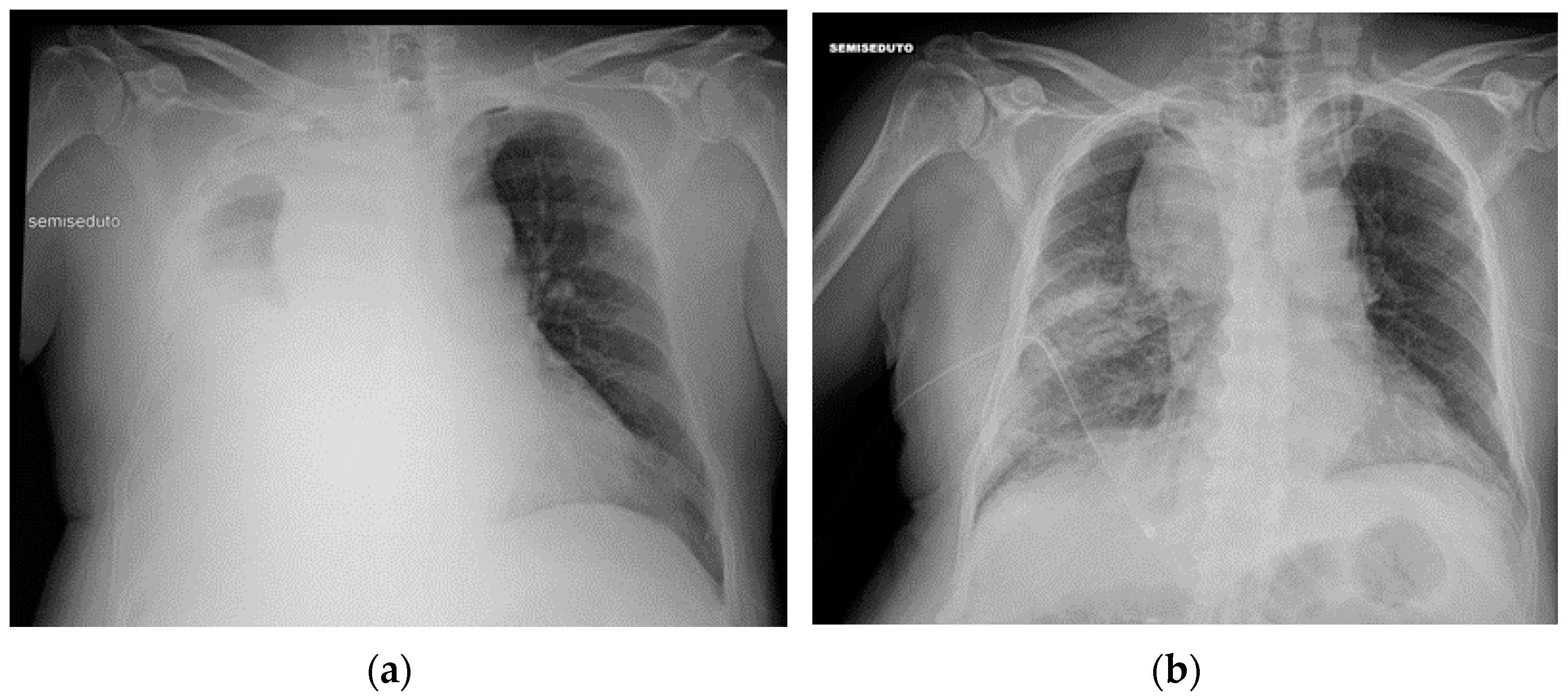 Diagnostics 13 00599 g030 Diagnostics 13 00599 g030