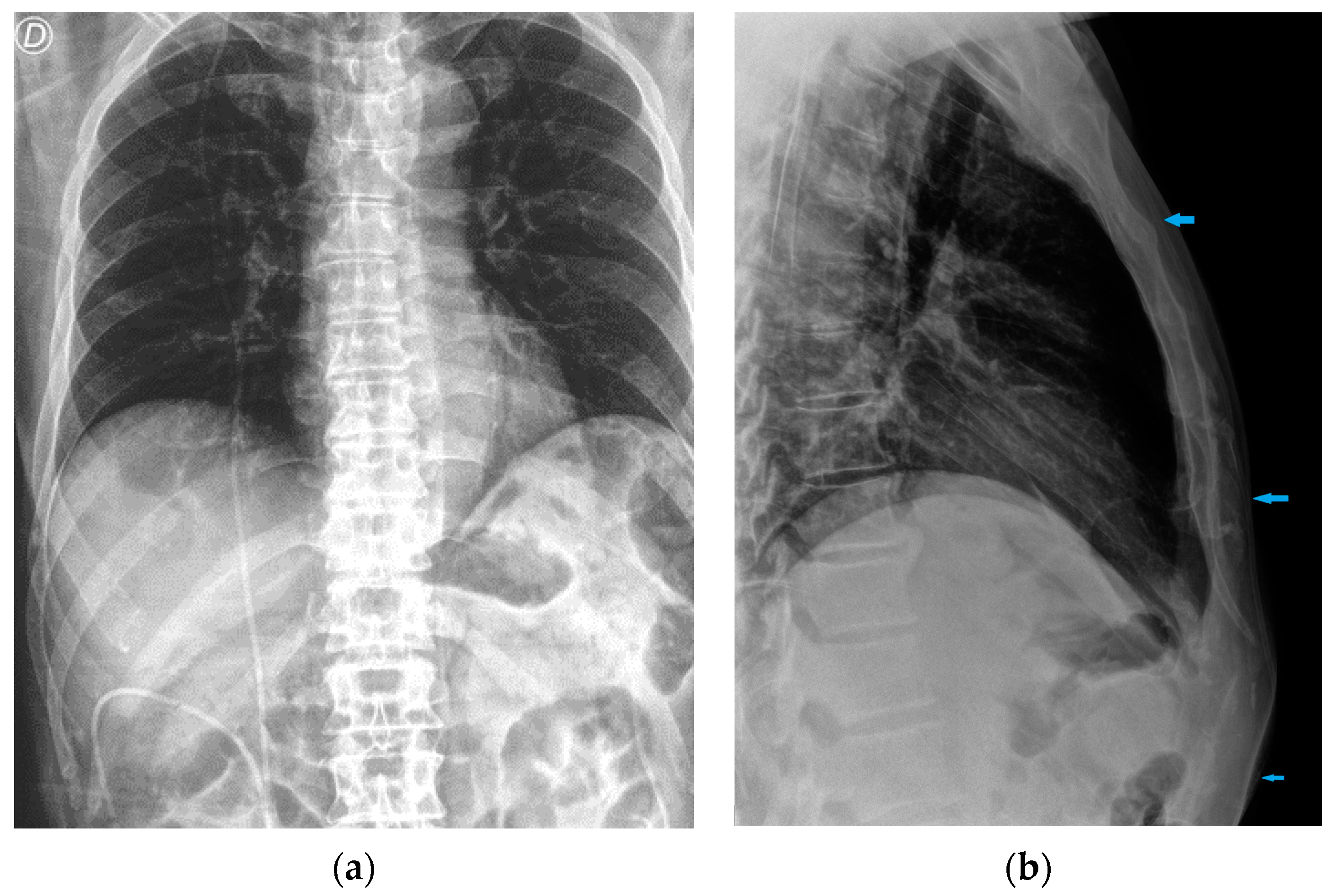 Diagnostics 13 00599 g032 Diagnostics 13 00599 g032