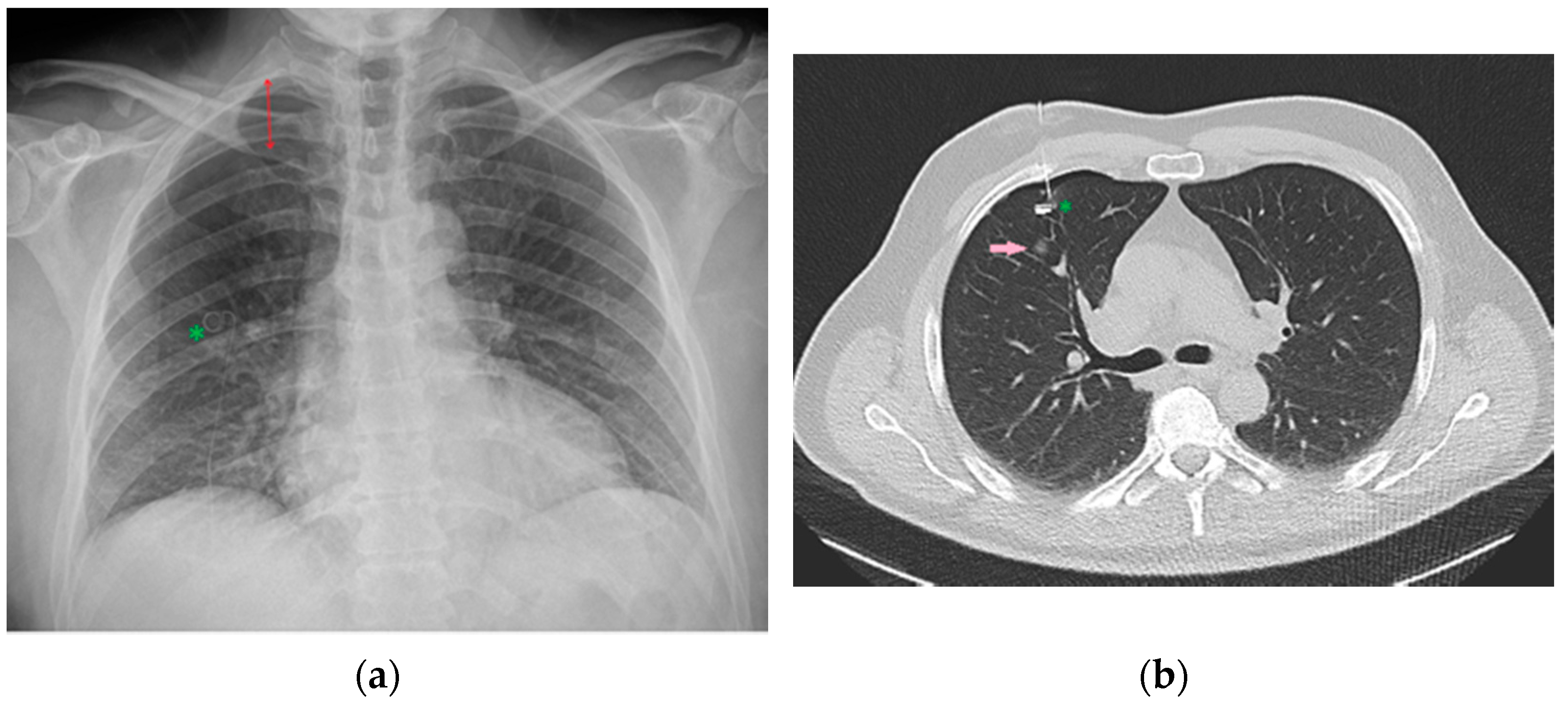 Diagnostics 13 00599 g034 Diagnostics 13 00599 g034