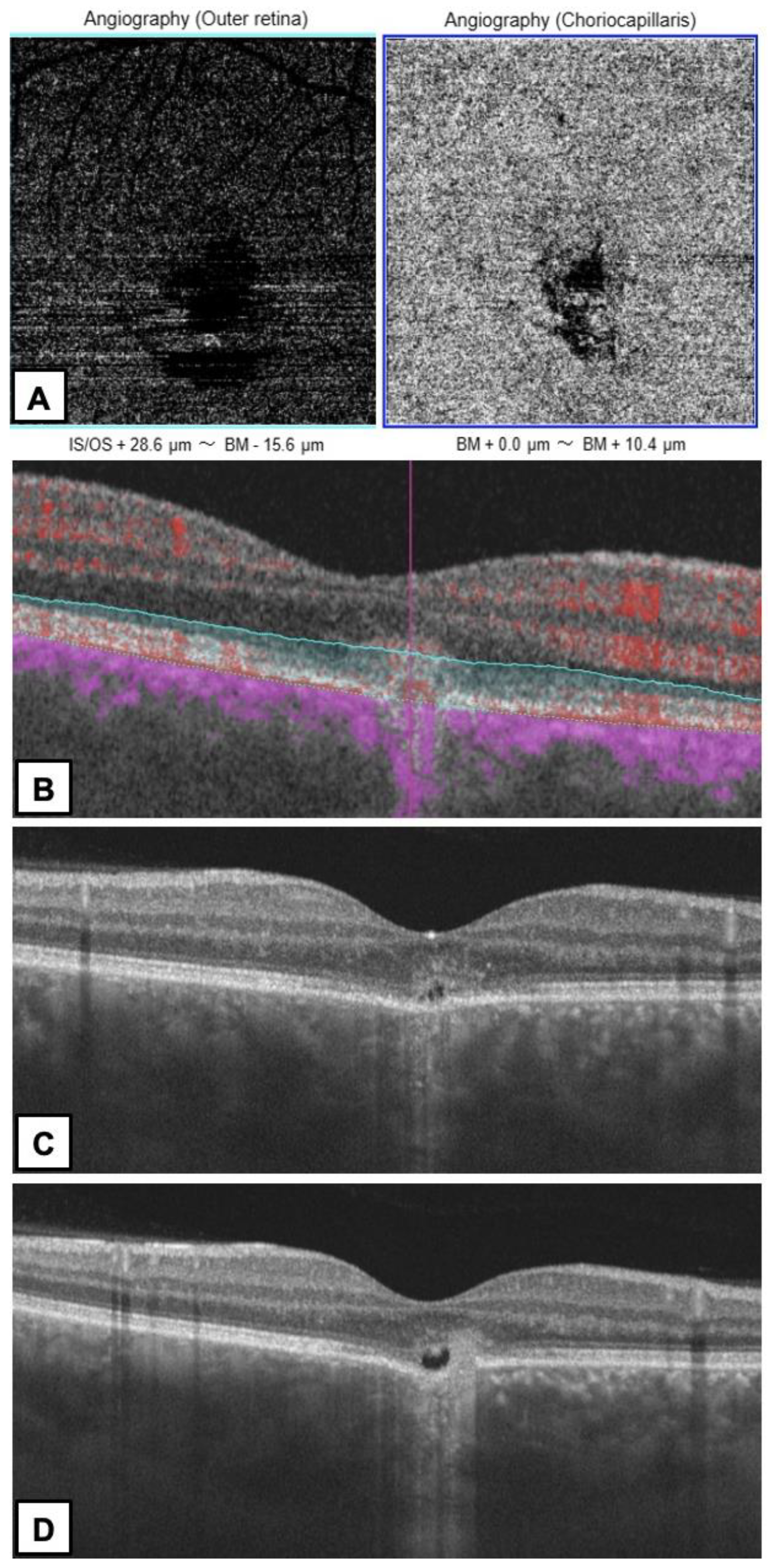 Diagnostics 13 00602 g004