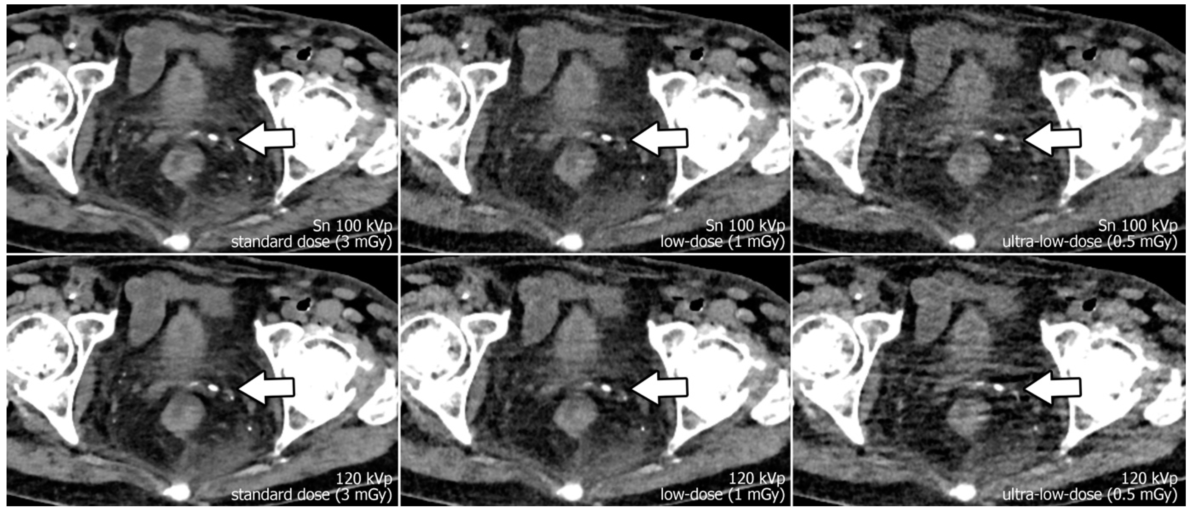 Diagnostics 13 00603 g001