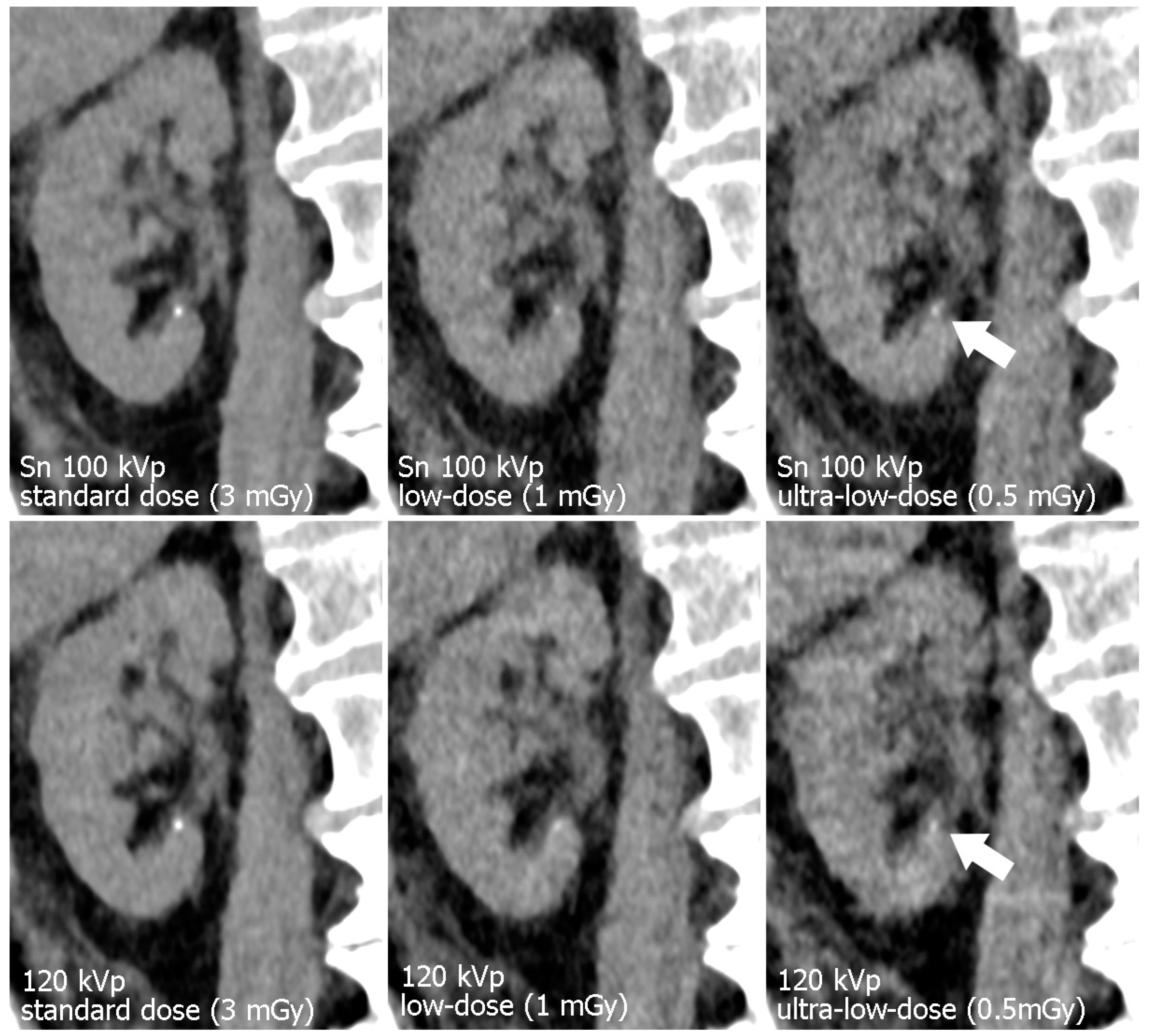 Diagnostics 13 00603 g004