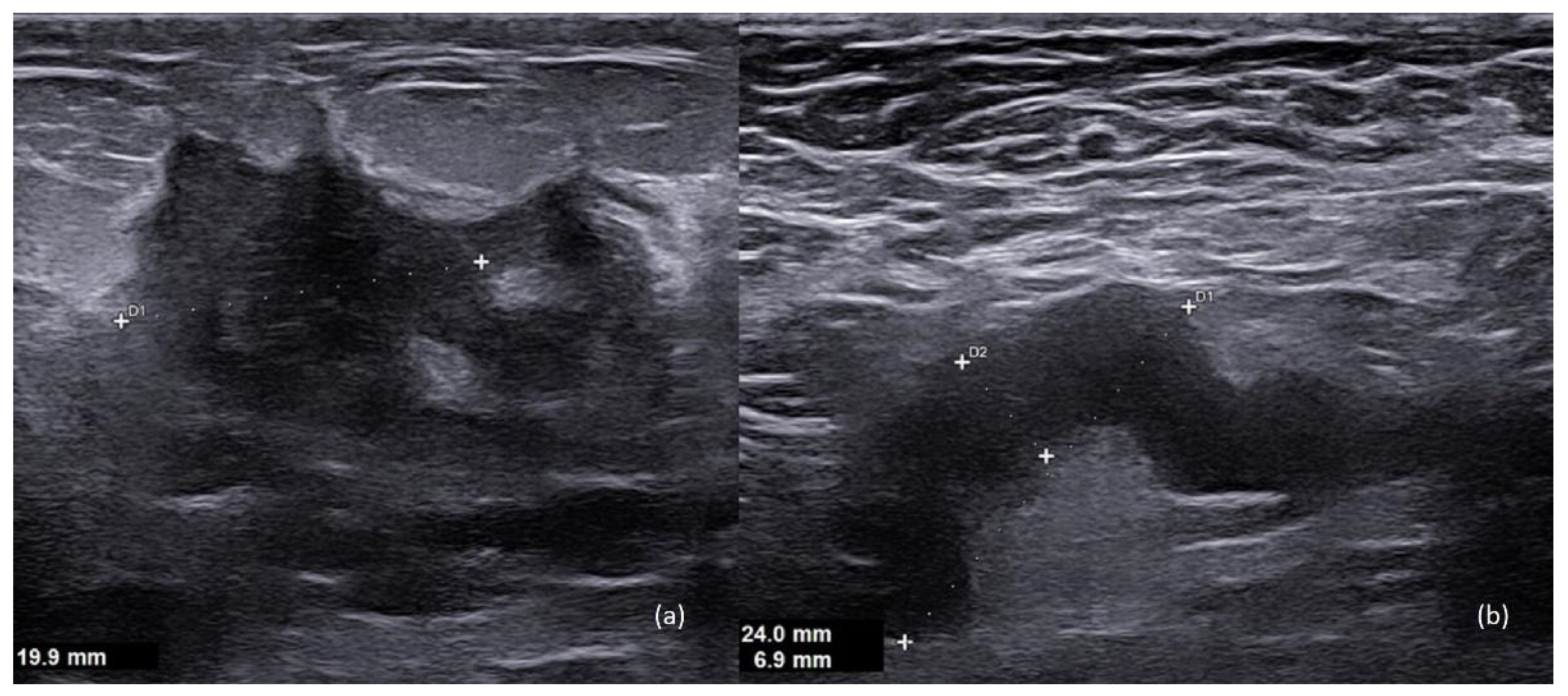 Diagnostics 13 00604 g001