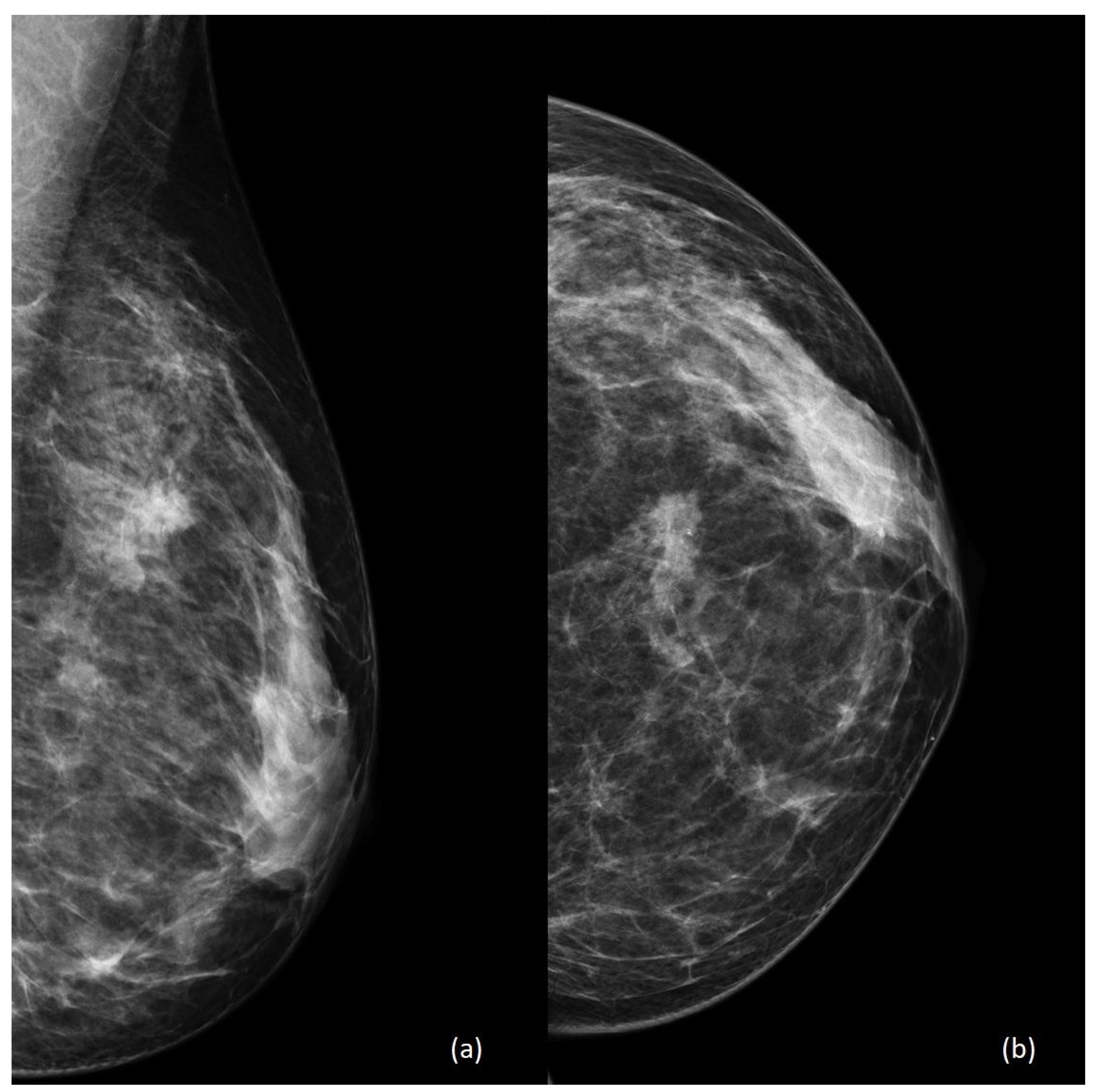 Diagnostics 13 00604 g002