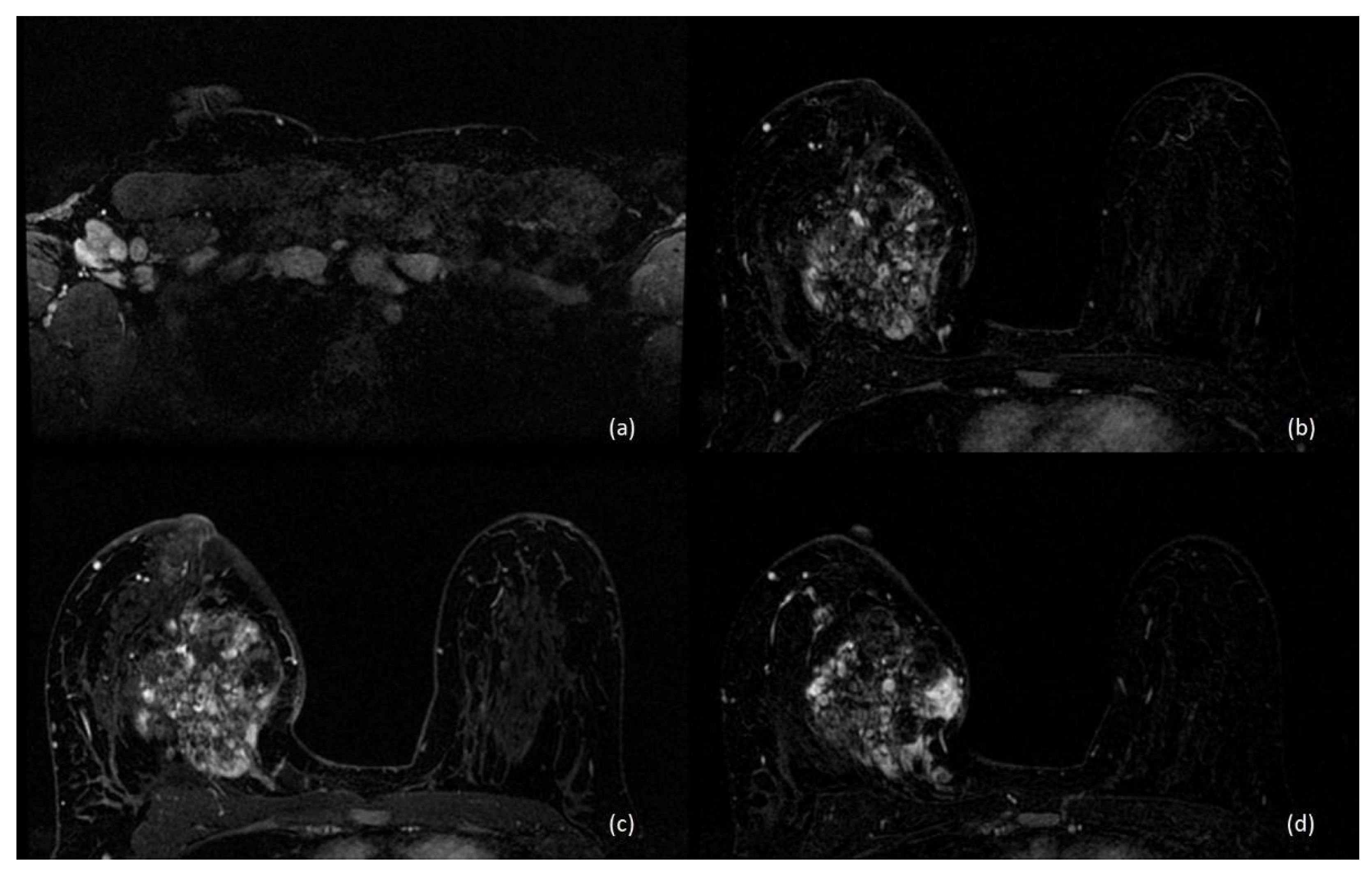 Diagnostics 13 00604 g004