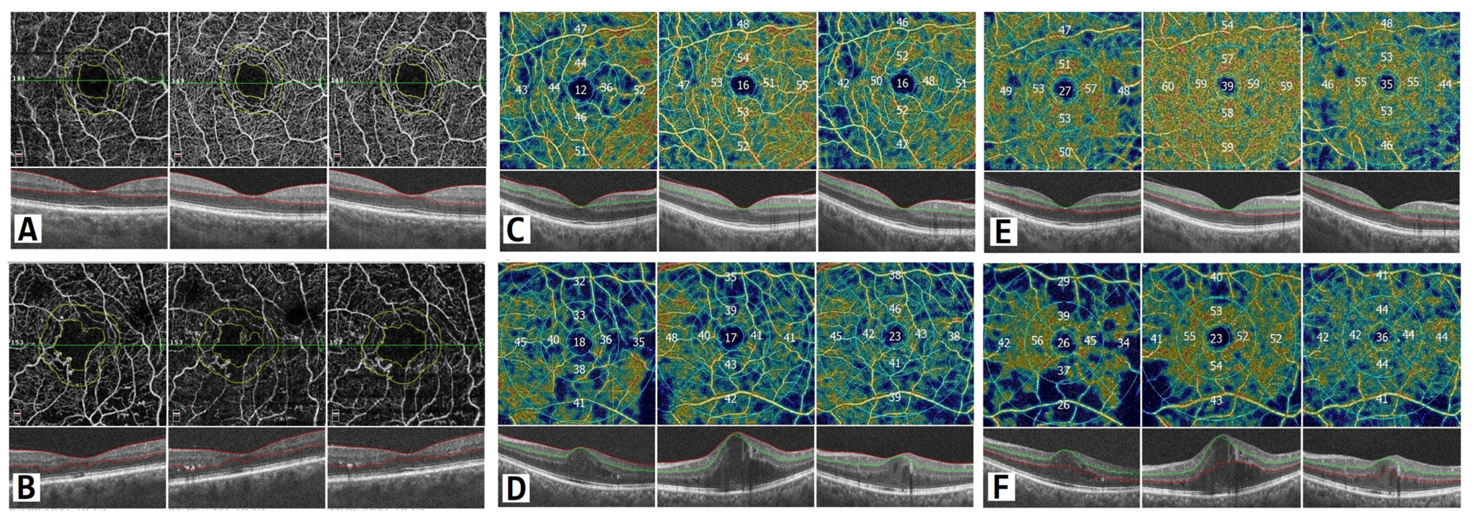 Diagnostics 13 00605 g004