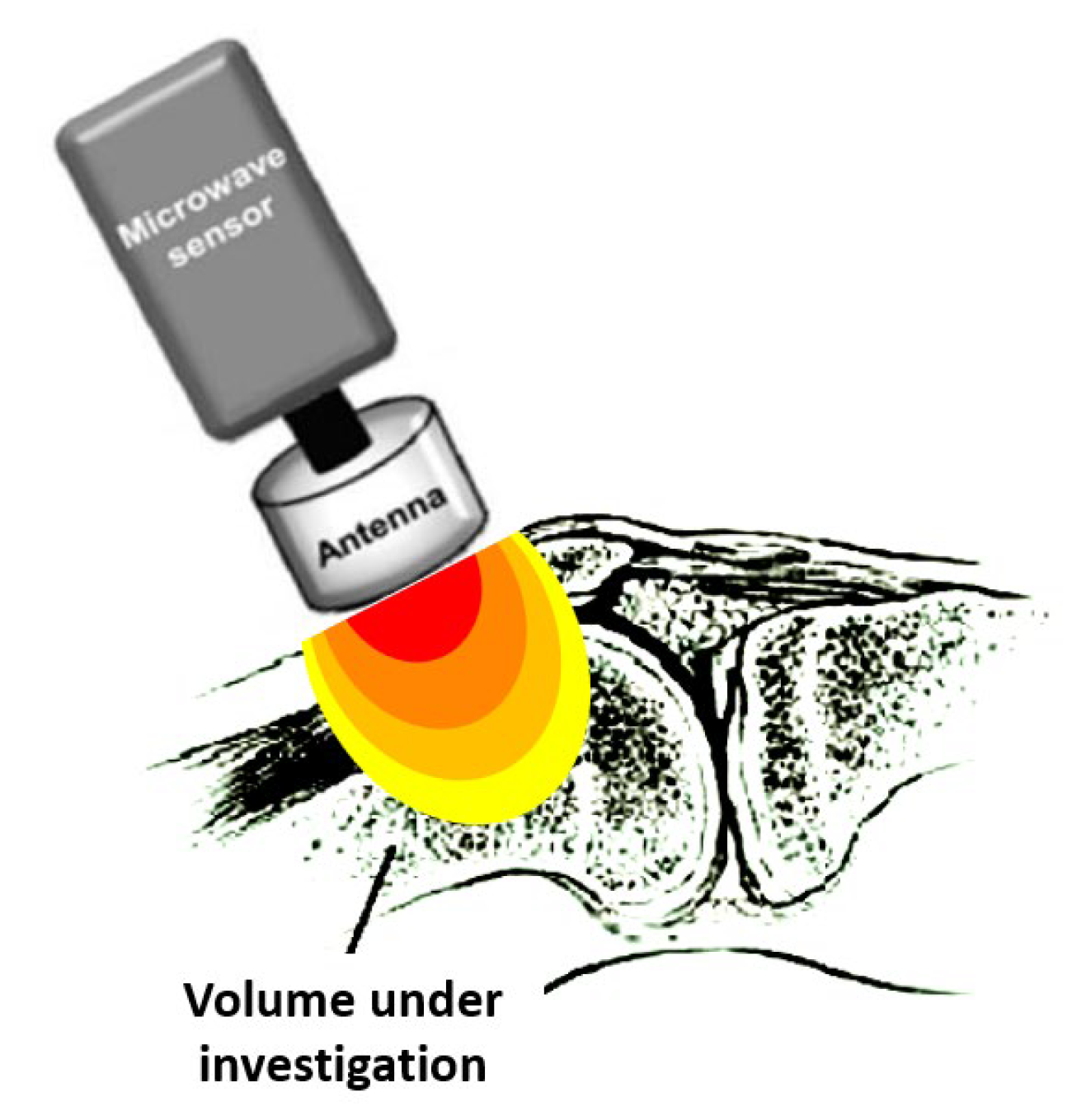 Diagnostics 13 00609 g001