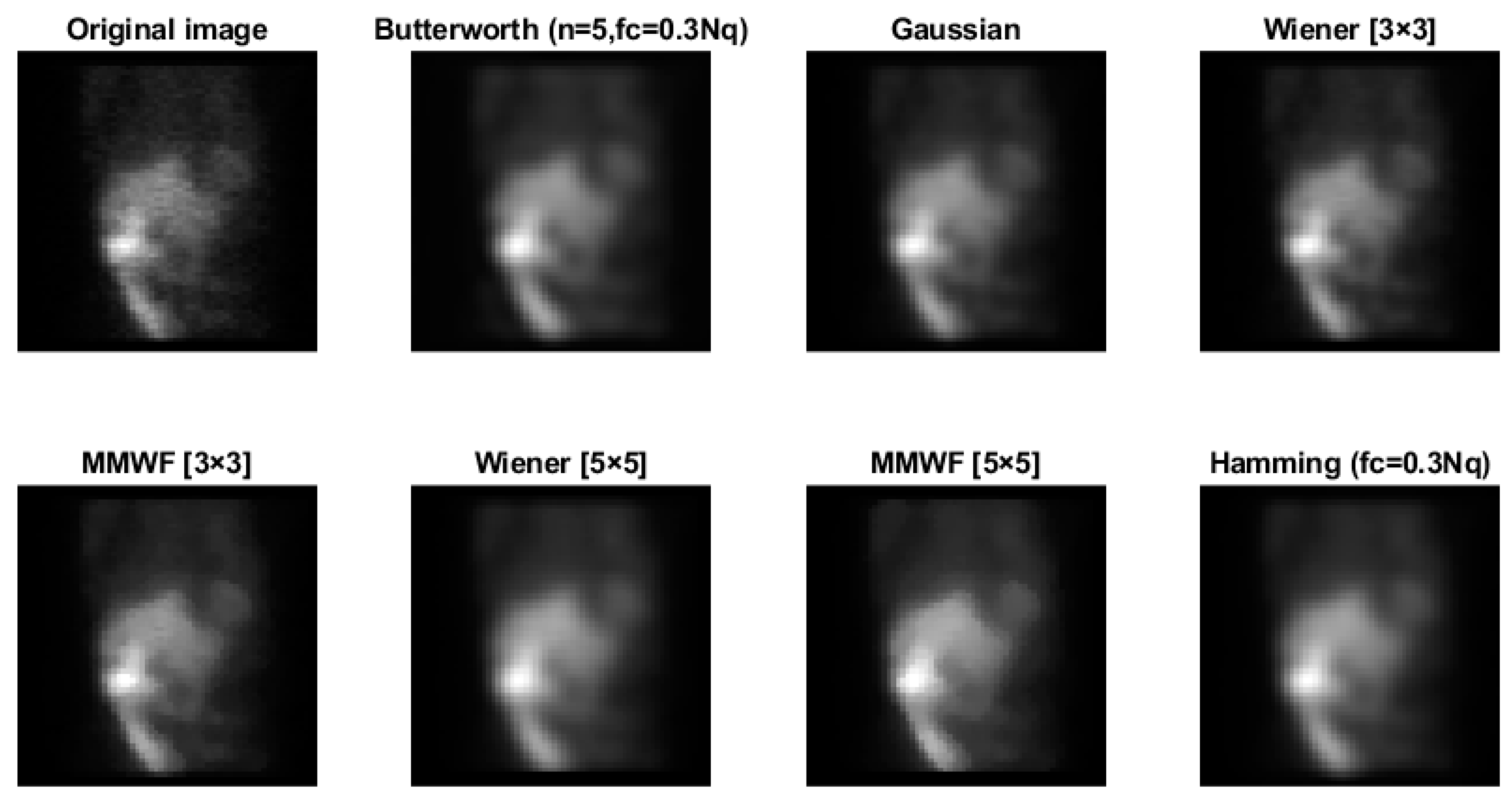 Diagnostics 13 00611 g007