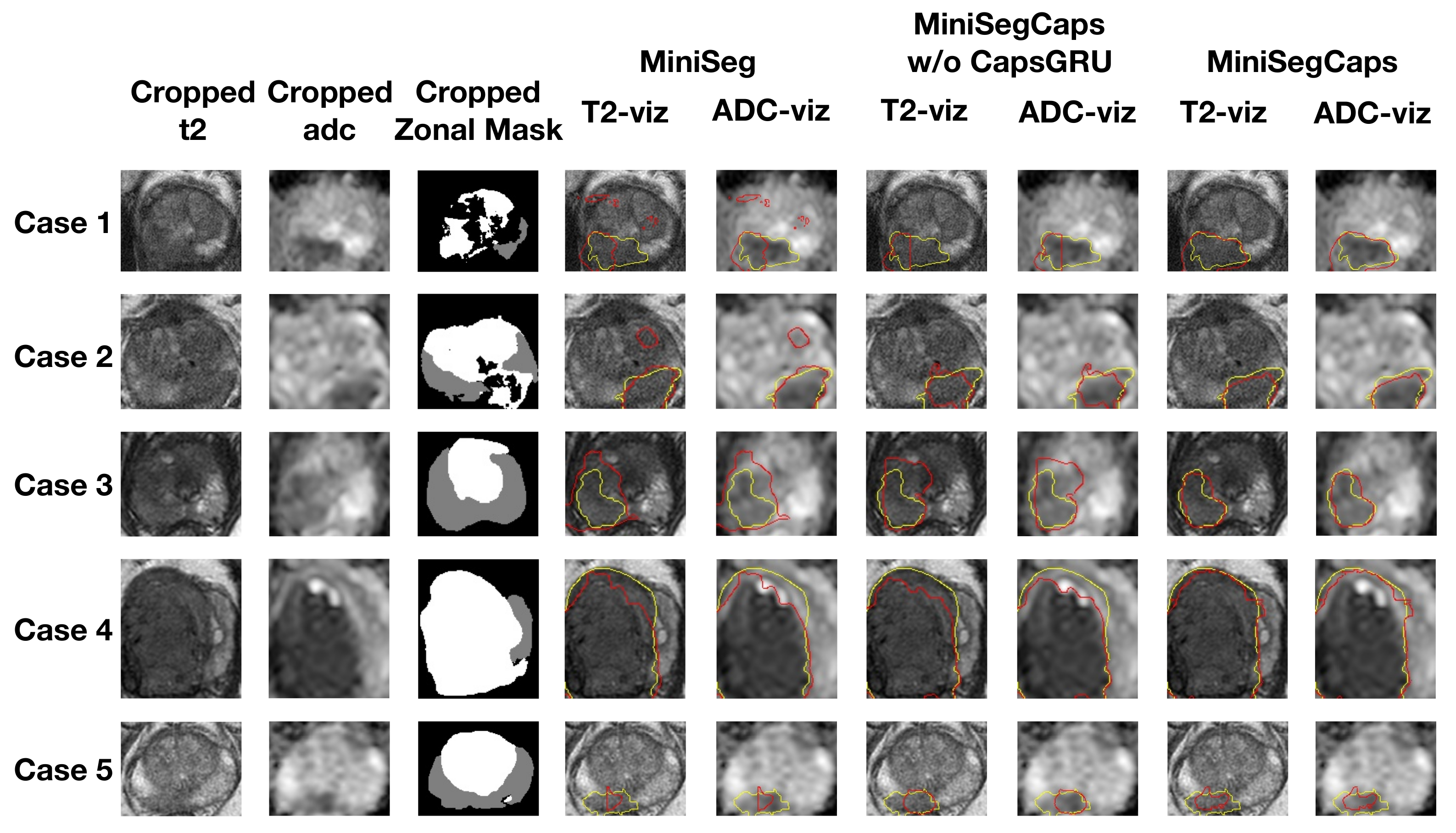 Diagnostics 13 00615 g004