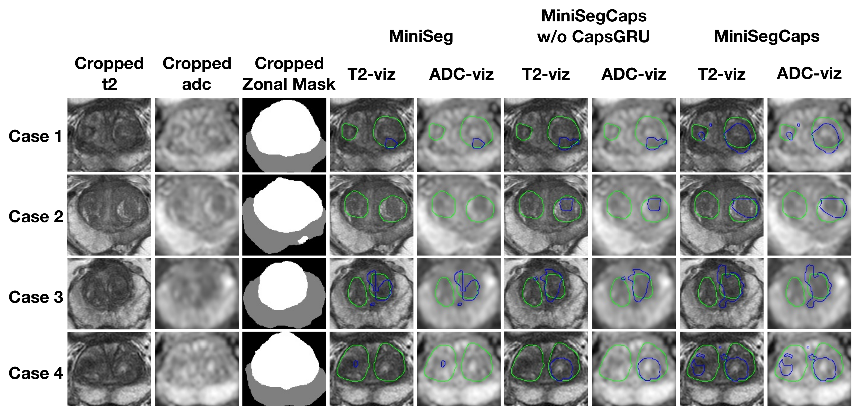 Diagnostics 13 00615 g006