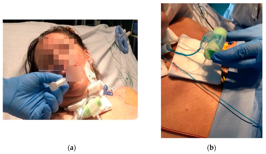 Diagnostics 13 00616 g001