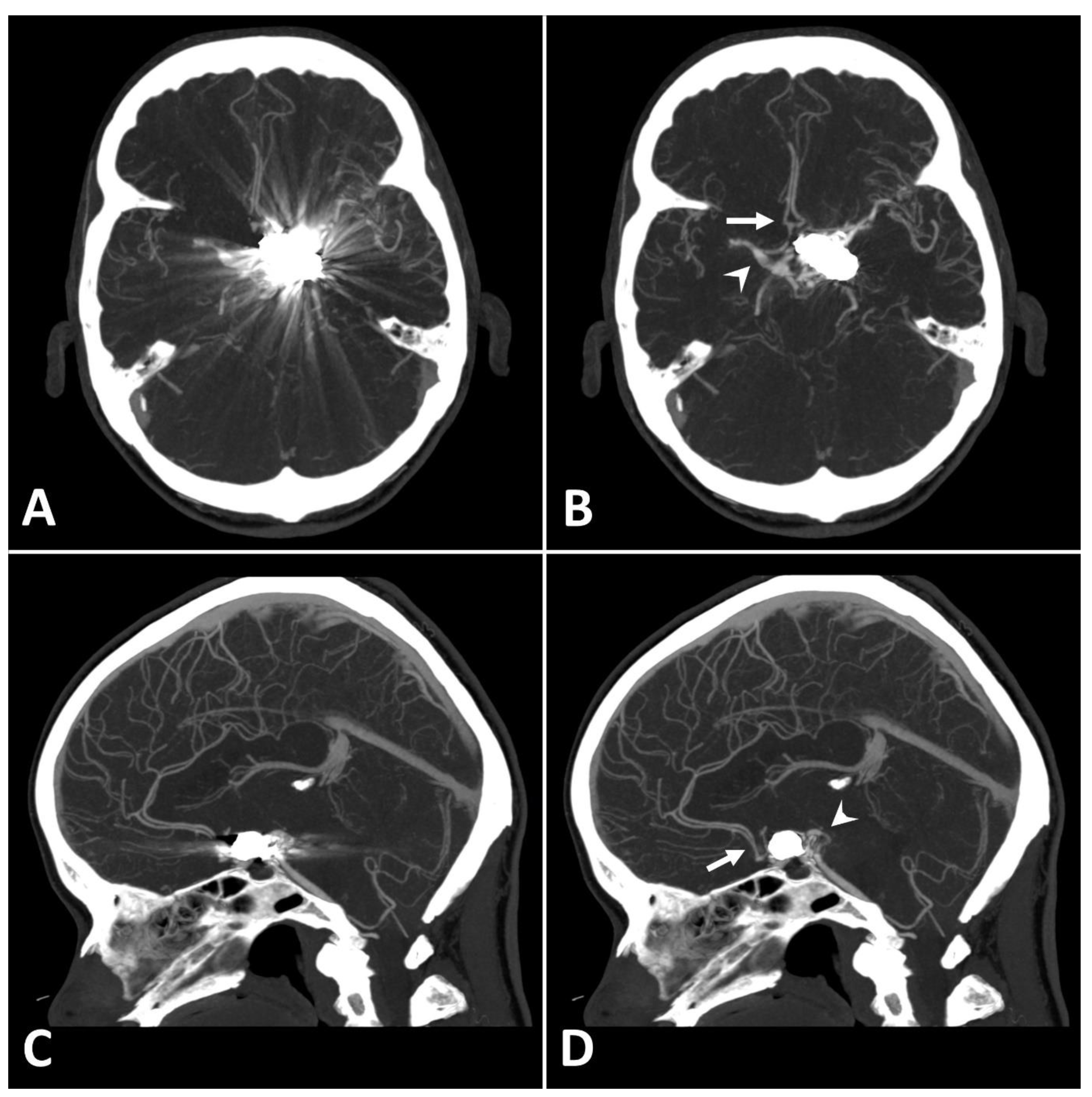 Diagnostics 13 00620 g002