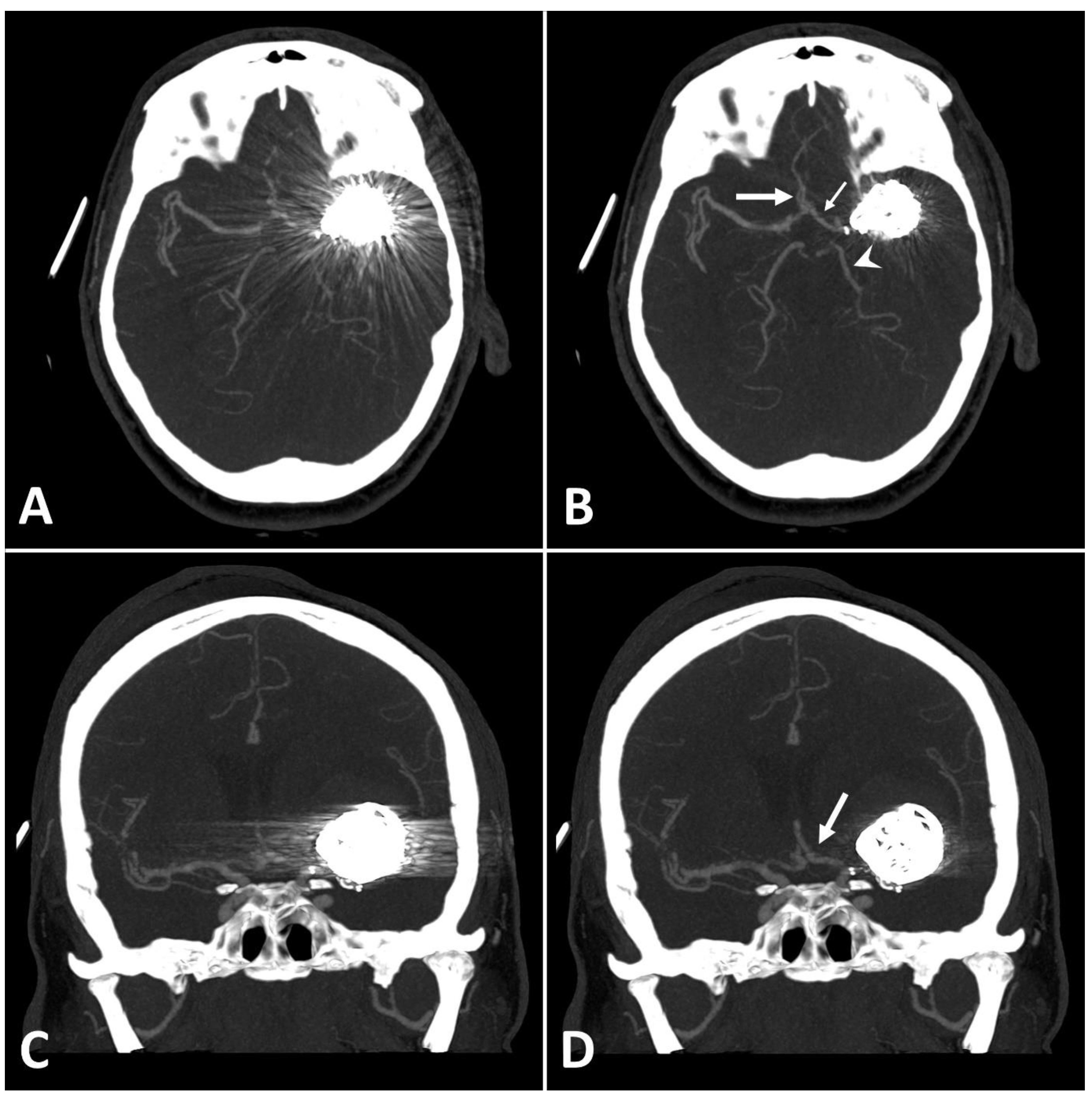 Diagnostics 13 00620 g003