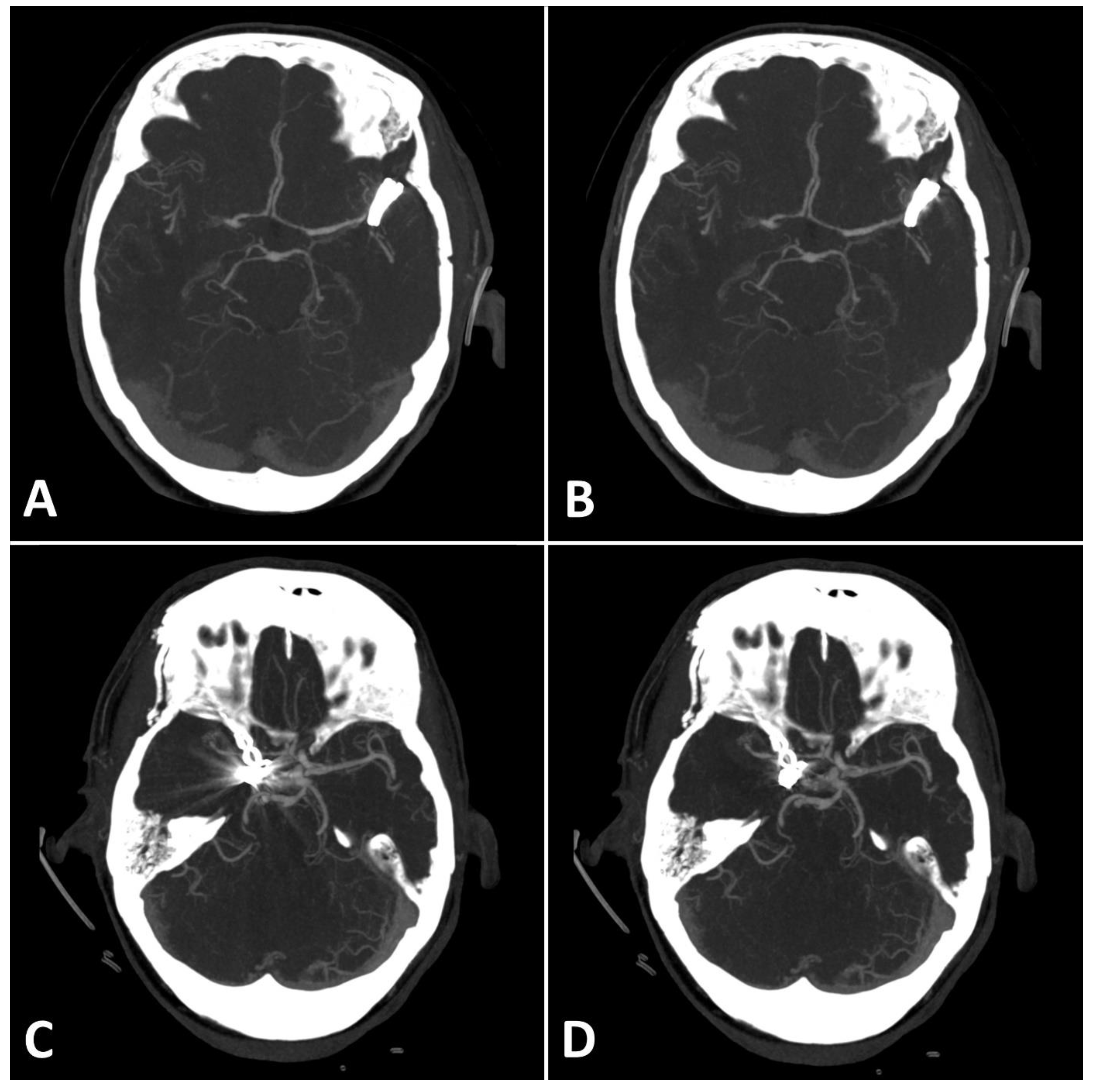 Diagnostics 13 00620 g004