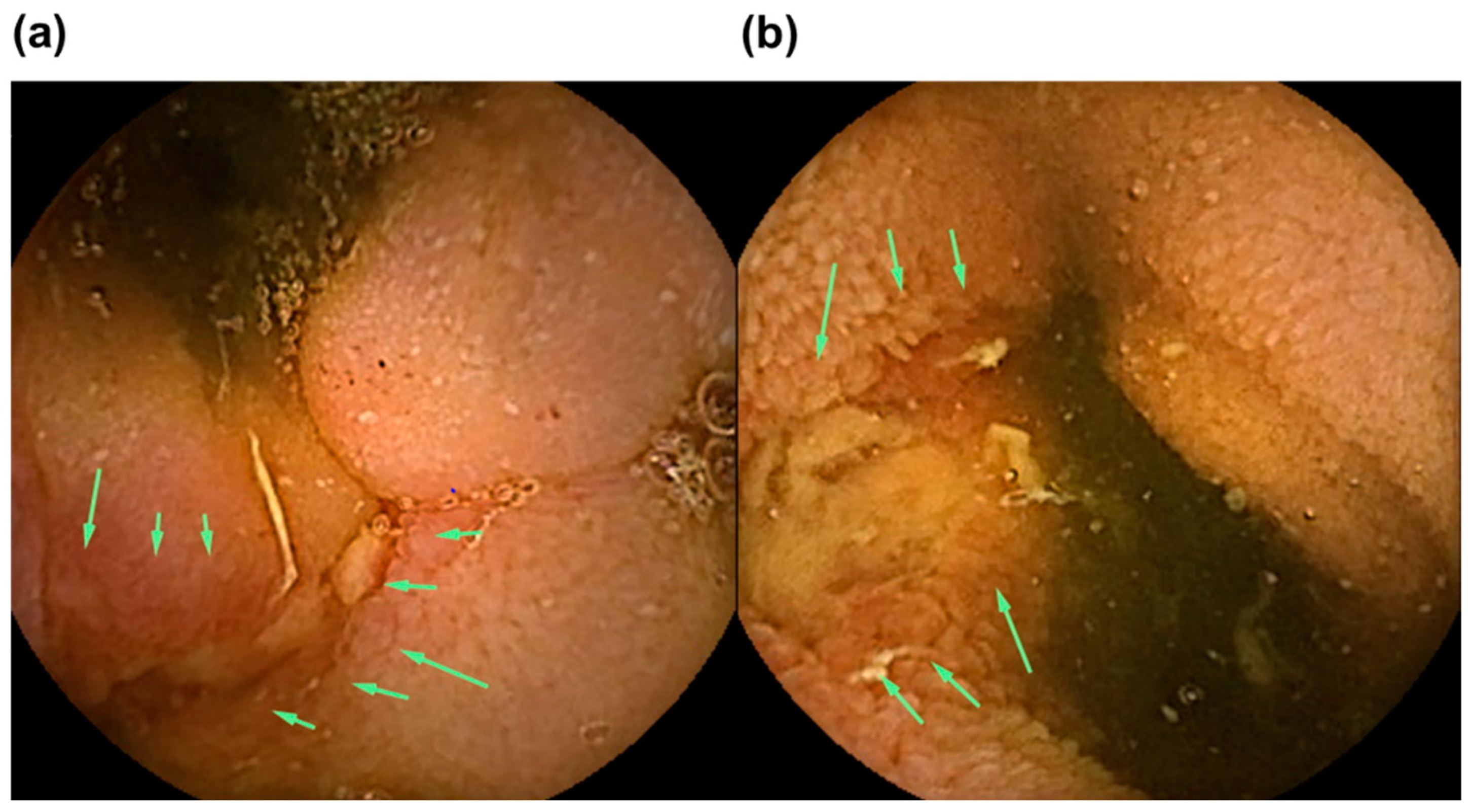 Diagnostics 13 00626 g006