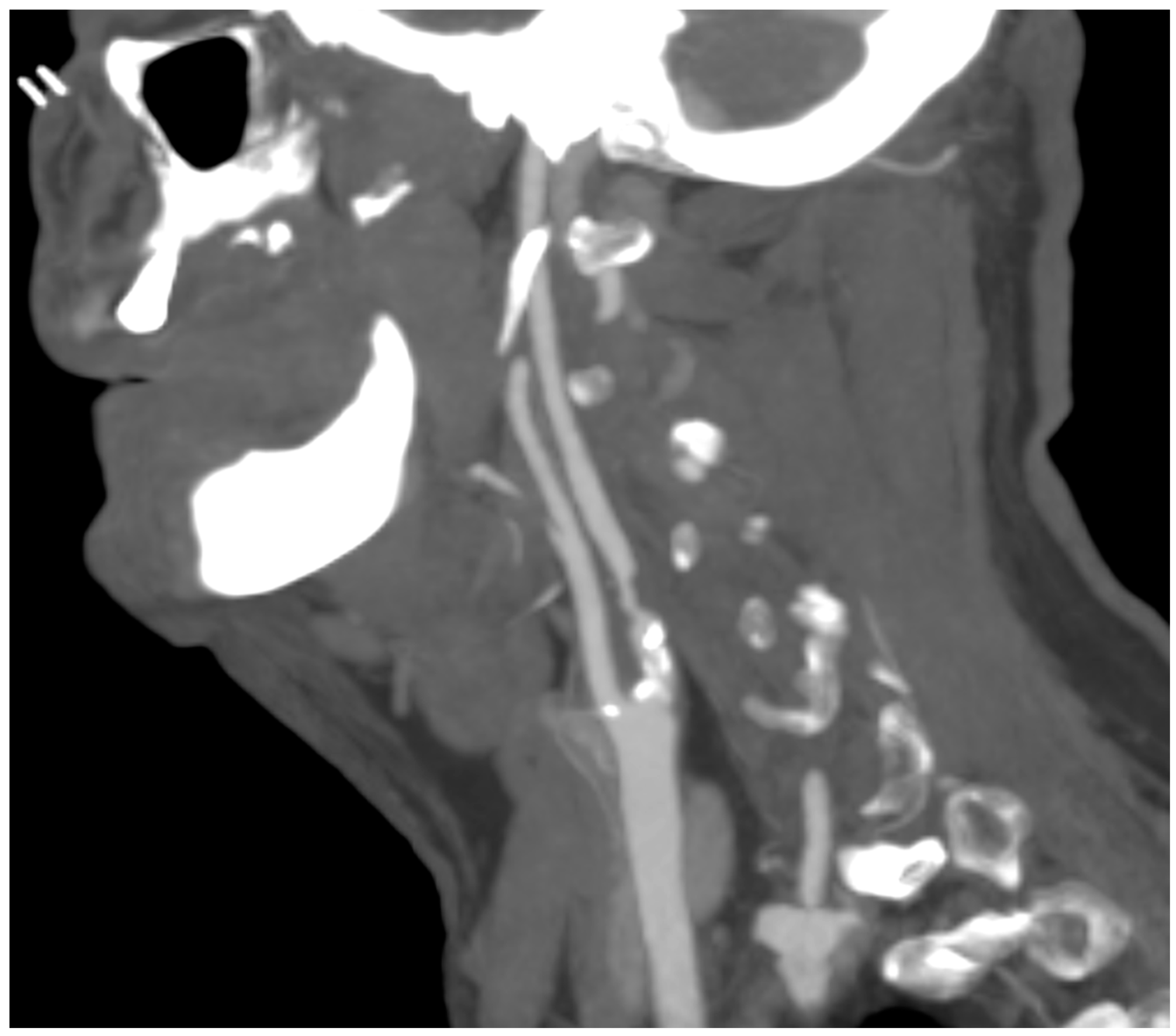 Diagnostics 13 00644 g003 Diagnostics 13 00644 g003