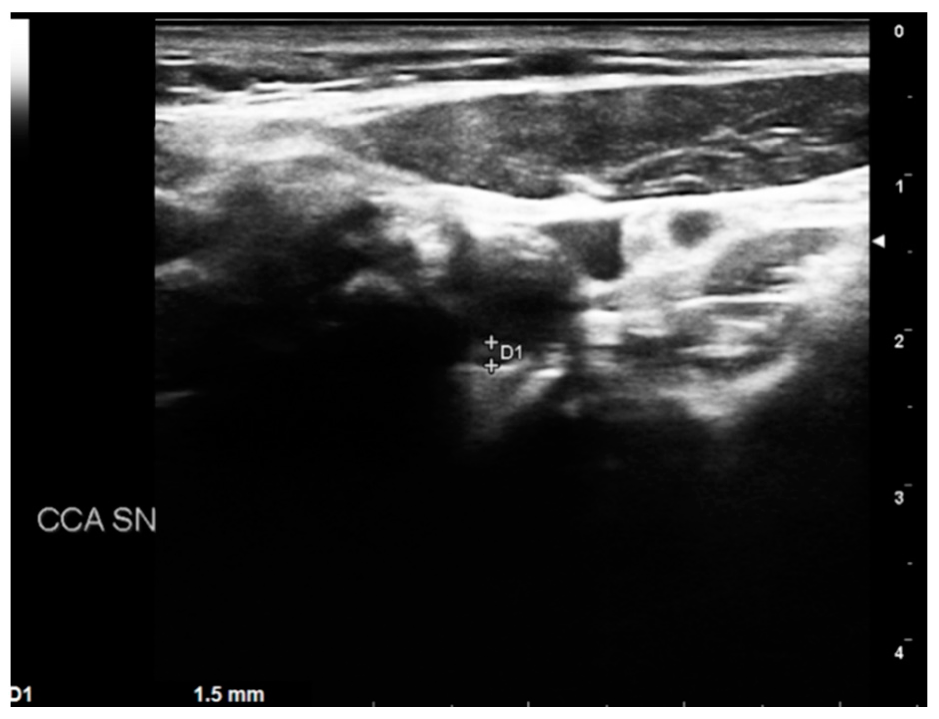 Diagnostics 13 00644 g004 Diagnostics 13 00644 g004